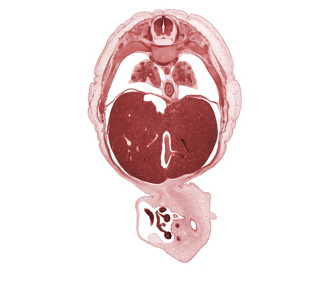 T-7 spinal ganglion, allantois, aorta, distal limb of herniated midgut, dorsal meso-esophagus, ductus venosus, esophagus, inferior vena cava, left lobe of liver, left umbilical artery, lower lobe of left lung, lower lobe of right lung, proximal limb of herniated midgut, rib 8, rib 9, right lobe of liver, right umbilical artery, sympathetic trunk, umbilical vein, umbilical vesicle stalk