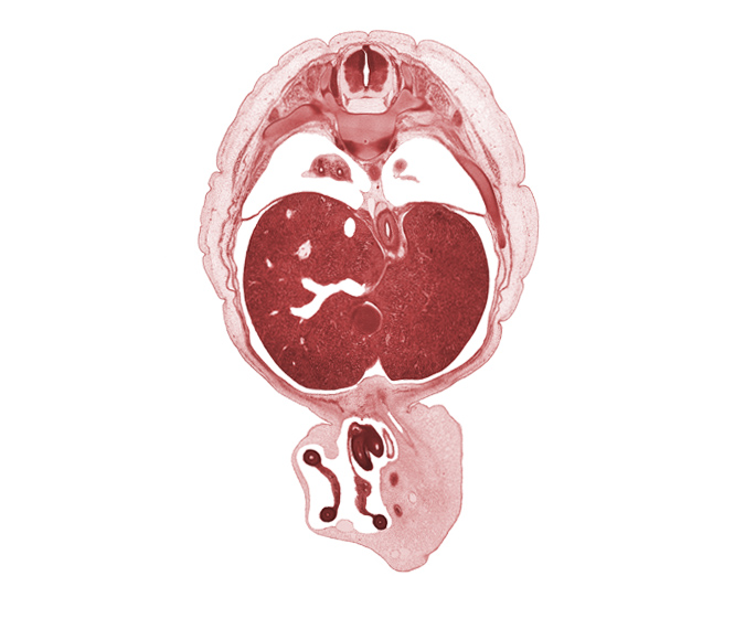 T-9 spinal ganglion, afferent hepatic vein, allantois, anterior gastric nerve (CN X), aorta, bronchogenic mesoderm, caudal edge of left lung, caudal edge of umbilical vein, cephalic edge of pyloric antrum of stomach, distal limb of herniated midgut, esophagus, left umbilical artery, lesser sac (omental bursa), pleural cavity, pleural recess, posterior gastric nerve (CN X), proximal limb of herniated midgut, rib 10, right lobe of liver, right umbilical artery, umbilical cord