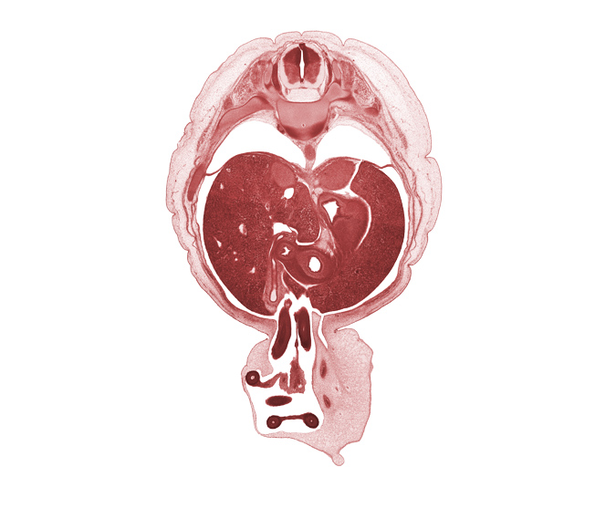 T-10 spinal ganglion, aorta, caudate lobe of liver, cystic duct, distal limb of herniated midgut, gall bladder, head of pancreas, left lobe of liver, lesser curvature of stomach, pleural cavity, pleural recess, proximal limb of herniated midgut, pyloric antrum of stomach, right lobe of liver, suprarenal gland cortex, umbilical coelom, umbilical cord, umbilical vesicle stalk