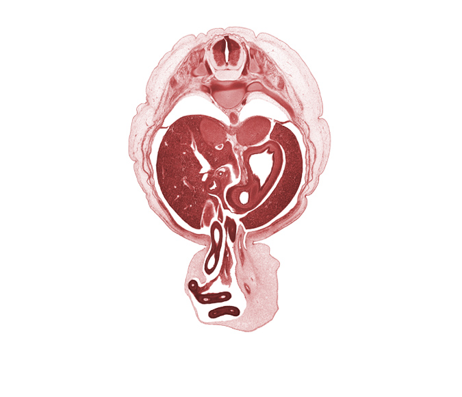 T-10 / T-11 intervertebral disc, T-10 spinal ganglion, T-10 spinal nerve, allantois, aorta, bile duct, body of stomach, distal limb of midgut, duodenum, fundus of stomach, hepatic artery, hepatic portal vein, intermediate zone, latissimus dorsi muscle, left umbilical artery, marginal zone, pleural recess, proximal limb of herniated midgut, pyloric antrum of stomach, rib 11, right umbilical artery, sympathetic trunk, umbilical cord, ventricular zone