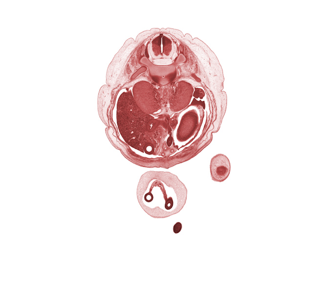 T-11 / T-12 interganglion region, T-12 / L-1 intervertebral disc, aorta, duodenum, junction of allantois and apex of urinary bladder, medial condyle of femur, mesonephros, muscularis of stomach, notochord, proximal limb of herniated midgut, right lobe of liver, spleen, subcostal nerve (T-12), suprarenal gland medulla, toe of left foot, umbilical coelom, umbilical cord