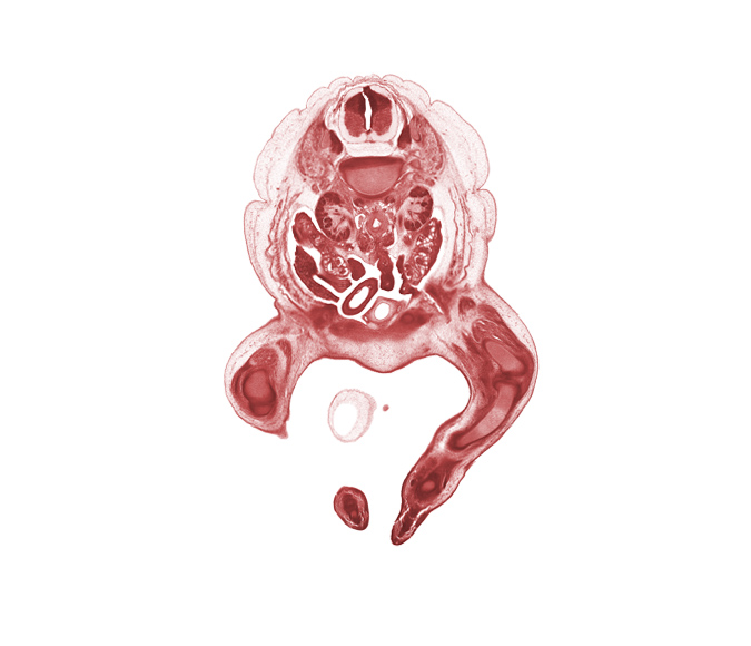 L-1 spinal ganglion, L-1 spinal nerve, amnion on surface of umbilical cord, aorta, degenerating mesonephros, duodenum, gubernaculum of ovary, intermediate zone, kidney (metanephros), knee joint, marginal zone, paramesonephric duct, patellar ligament, pubis, quadriceps femoris muscle, right umbilical artery, subarachnoid space, sympathetic trunk, tibia, toe, toe of right foot, urinary bladder, ventricular zone