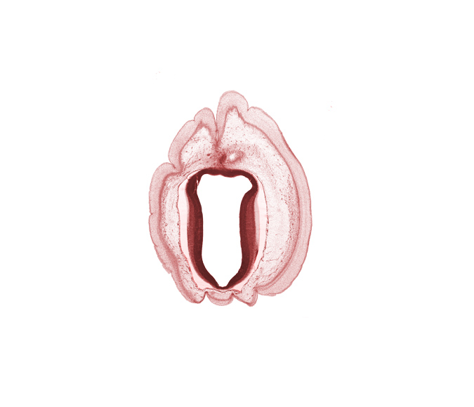 artifact space(s), cephalic edge of metencephalon, cerebral aqueduct (mesocoele), mesencephalon, osteogenic layer, subarachnoid space, surface ectoderm