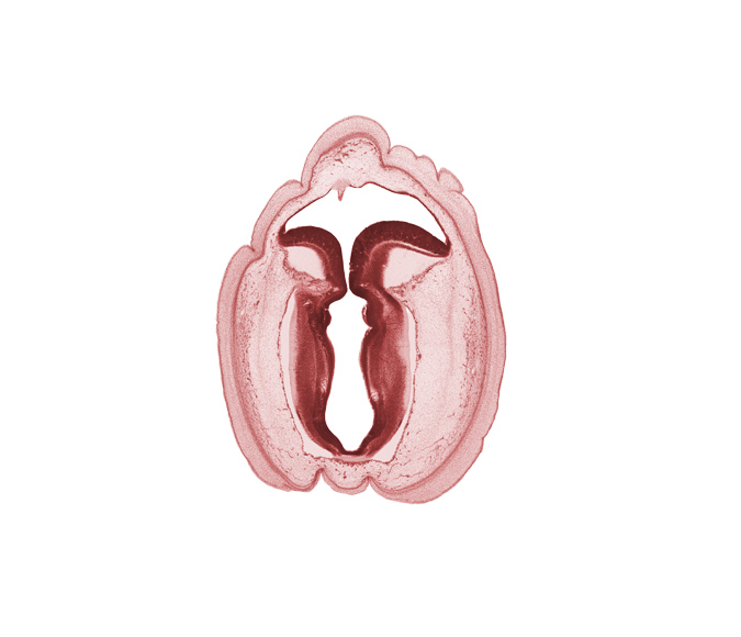 alar plate(s), artifact space(s), basal plate, commissure in roof plate of mesencephalon, fiber tract, intermediate zone, isthmus of rhombencephalon, marginal zone, rhombencoel (fourth ventricle), roof of rhombencoel (fourth ventricle), sulcus limitans, ventricular zone