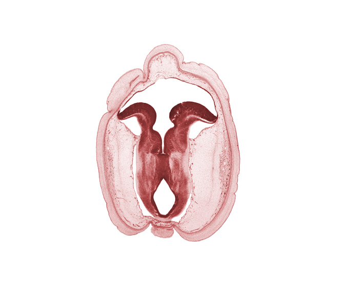 cerebral aqueduct (mesocoele), commissure in roof plate of mesencephalon, fiber tract, floor plate, head mesenchyme, middle dural venous plexus, osteogenic layer, roof plate of metencephalon, subarachnoid space, surface ectoderm, trochlear nerve (CN IV)