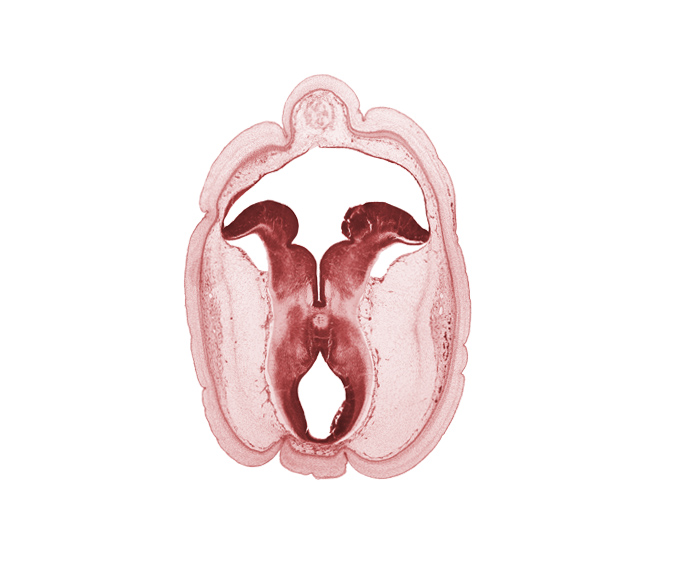 alar plate of metencephalon (cerebellum), artifact fracture(s), artifact space(s), basal plate, cerebral peduncle, edge of diverticulum of rhombencoel (fourth ventricle), interpeduncular fossa, osteogenic layer, rhombencoel (fourth ventricle), roof plate, subarachnoid space, sulcus limitans, surface ectoderm, trochlear nerve (CN IV), vascular plexus