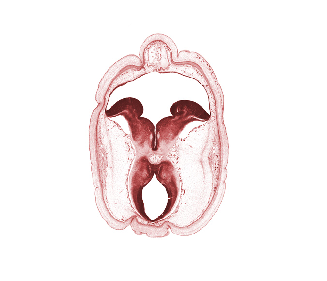 artifact space(s), cerebral aqueduct (mesocoele), cerebral peduncle, diverticulum of rhombencoel (fourth ventricle), floor plate, head mesenchyme, interpeduncular fossa, rhombencoel (fourth ventricle), roof plate, subarachnoid space, sulcus limitans, surface ectoderm, trochlear nerve (CN IV)