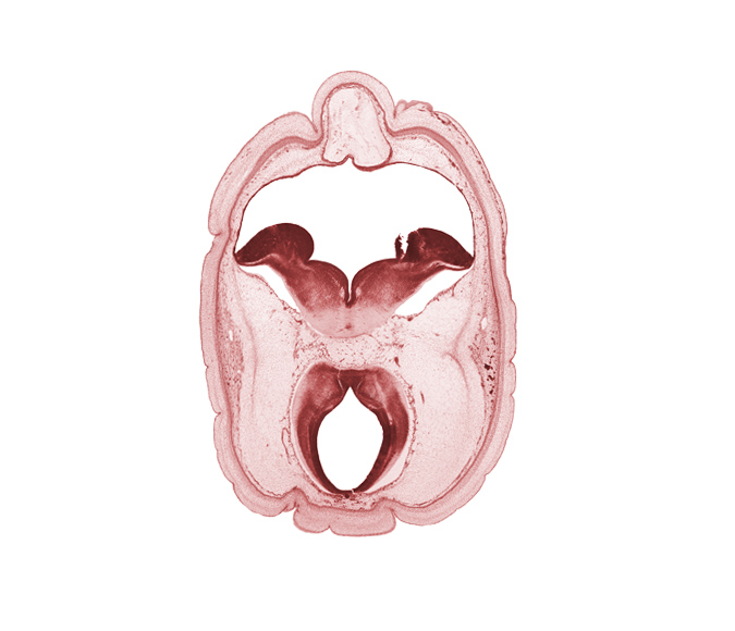 alar plate(s), artifact fracture(s), artifact space(s), basal plate, diverticulum of rhombencoel (fourth ventricle), intermediate zone, marginal zone, mesencephalon, metencephalon, middle dural venous plexus, oculomotor nerve (CN III), pons region (metencephalon), posterior cerebral artery, rhombencoel (fourth ventricle), roof plate, ventricular zone