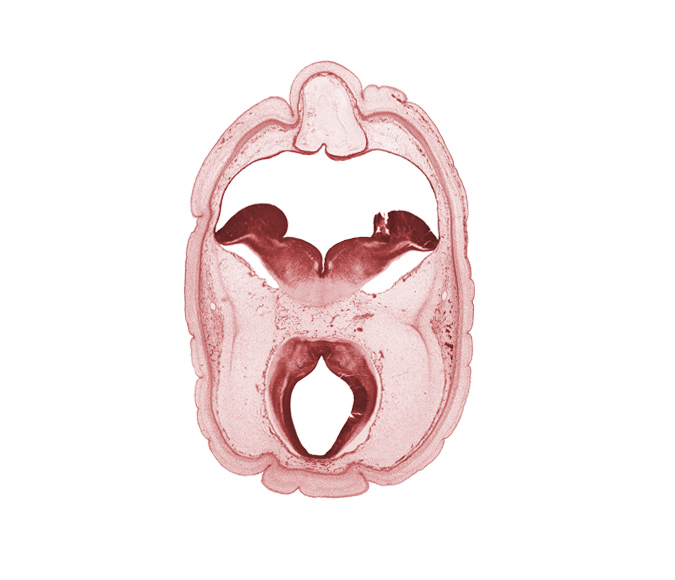 artifact fracture(s), cerebral aqueduct (mesocoele), diverticulum of rhombencoel (fourth ventricle), median sulcus, oculomotor nerve (CN III), osteogenic layer, roof plate of mesencephalon, roof plate of metencephalon, sulcus limitans, superficial vascular plexus, surface ectoderm, trochlear nerve (CN IV), vascular plexus