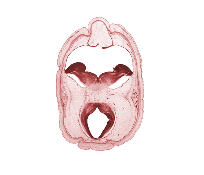 alar plate(s), basal plate, edge of choroid plexus, floor plate, head mesenchyme, oculomotor nerve (CN III), osteogenic layer, posterior cerebral artery, rhombencoel (fourth ventricle), roof plate, subarachnoid space, sulcus limitans, trochlear nerve (CN IV)