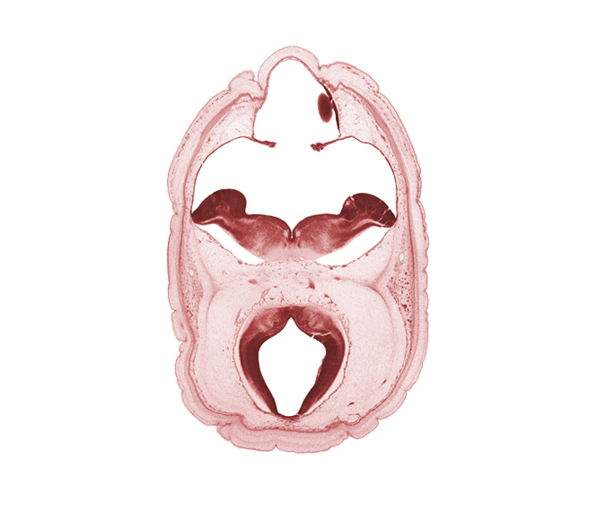 artifact space(s), cerebral aqueduct (mesocoele), choroid plexus, diverticulum of rhombencoel (fourth ventricle), edge of myelencephalon, middle dural venous plexus, pons region (metencephalon), posterior cerebral artery, rhombencoel (fourth ventricle), sulcus limitans, trochlear nerve (CN IV), venous plexus(es)