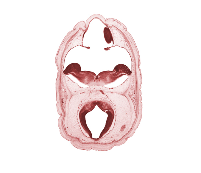 alar plate of metencephalon (cerebellum), artifact space(s), choroid plexus, diverticulum of rhombencoel (fourth ventricle), edge of cerebral vesicle (hemisphere), metencephalon, myelencephalon, oculomotor nerve (CN III), rhombencoel (fourth ventricle), roof plate, subarachnoid space, tectum of mesencephalon, trochlear nerve (CN IV), vascular plexus