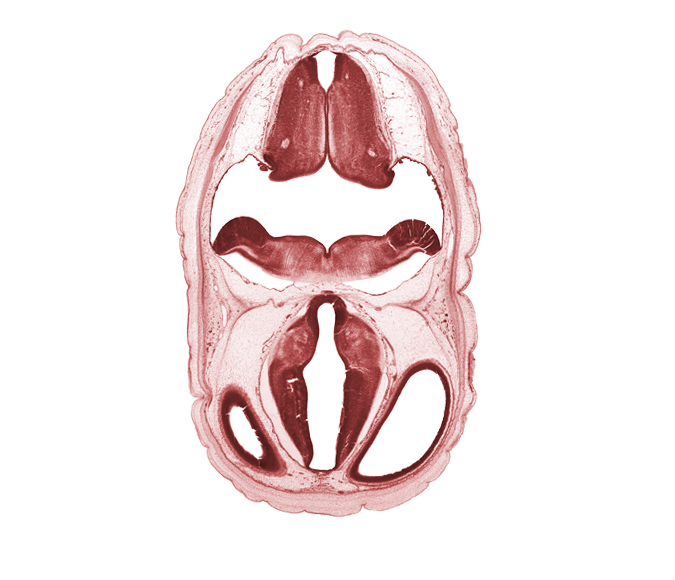 alar plate of metencephalon (cerebellum), artifact space(s), basal plate, edge of lateral ventricle, exoccipital, head mesenchyme, hypothalamic sulcus, hypothalamus, myelencephalon, oculomotor nerve (CN III), osteogenic layer, posterior communicating artery, subarachnoid space, sulcus limitans, surface ectoderm, trochlear nerve (CN IV), vascular plexus