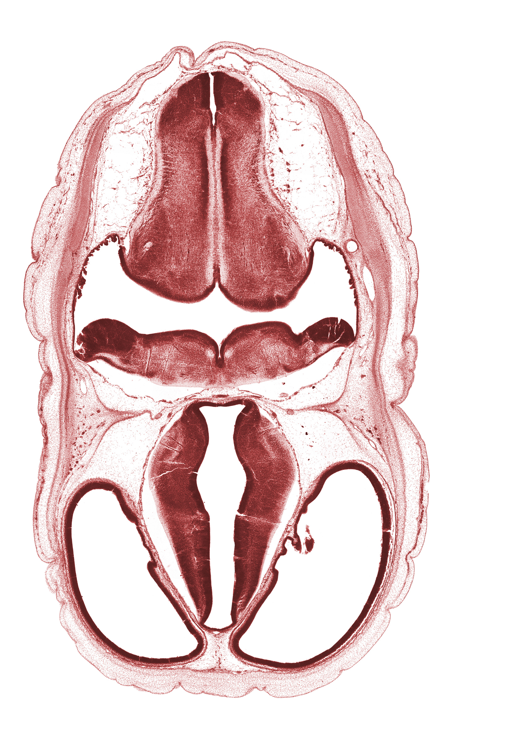 basilar artery, central canal of myelencephalon, cerebral vesicle (hemisphere), decussation, dorsal thalamus, endolymphatic sac, exoccipital, fiber tract, hypothalamus, intermediate zone, lateral ventricle, marginal zone, median sulcus, posterior communicating artery, posterior dural venous plexus, roof plate, third ventricle, ventral thalamus, ventricular zone