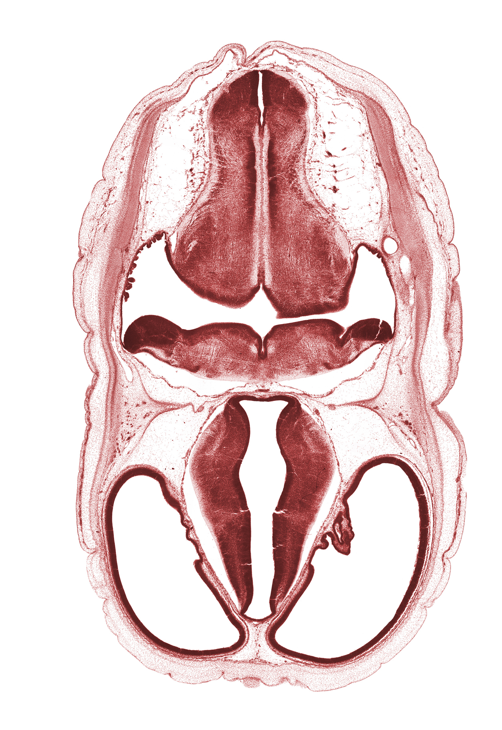 alar plate(s), basal plate, decussation in floor plate of myelencephalon, dorsal thalamus, edge of endolymphatic sac, exoccipital, hypothalamic sulcus, hypothalamus, osteogenic layer, pontine flexure region, roof plate, root of vagus nerve (CN X), stem of posterior dural venous plexus, subarachnoid space, sulcus dorsalis, sulcus medius, third ventricle, ventral thalamus