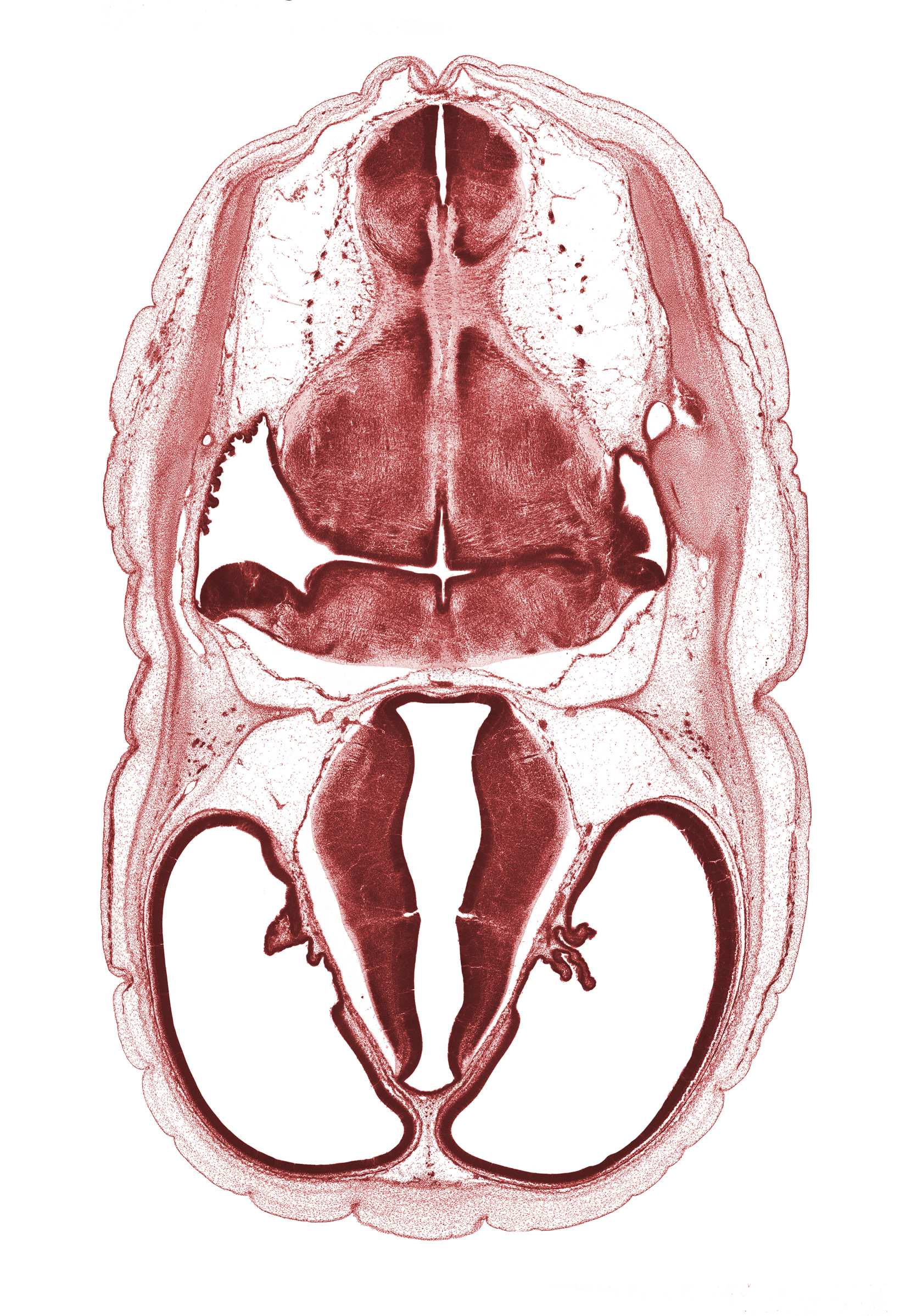 artifact space(s), basilar artery, choroid plexus, decussation in floor plate of myelencephalon, dorsal thalamus, endolymphatic duct, exoccipital, glossopharyngeal nerve (CN IX), hypothalamus, lateral recess of rhombencoel (fourth ventricle), lateral ventricle, median sulcus, otic capsule cartilage, posterior communicating artery, root of vagus nerve (CN X), sigmoid sinus, subarachnoid space, sulcus limitans, third ventricle, venous plexus(es), ventral thalamus