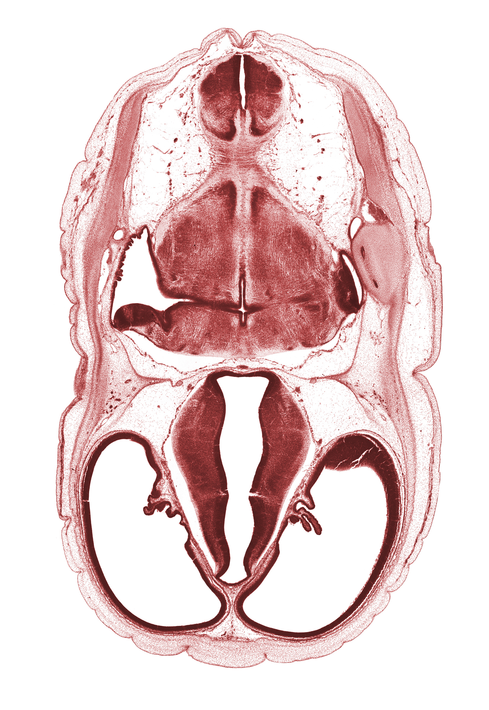 alar plate(s), basal plate, choroid plexus, decussation in floor plate, dorsal thalamus, dural band for tentorium cerebelli, endolymphatic duct, glossopharyngeal nerve (CN IX), hypothalamic sulcus, hypothalamus, lateral recess of rhombencoel (fourth ventricle), lateral ventricle, marginal ridge, oculomotor nerve (CN III), osteogenic layer, roof plate of myelencephalon, root of vagus nerve (CN X), sigmoid sinus, sulcus dorsalis, sulcus limitans, trochlear nerve (CN IV), venous plexus(es), ventral thalamus