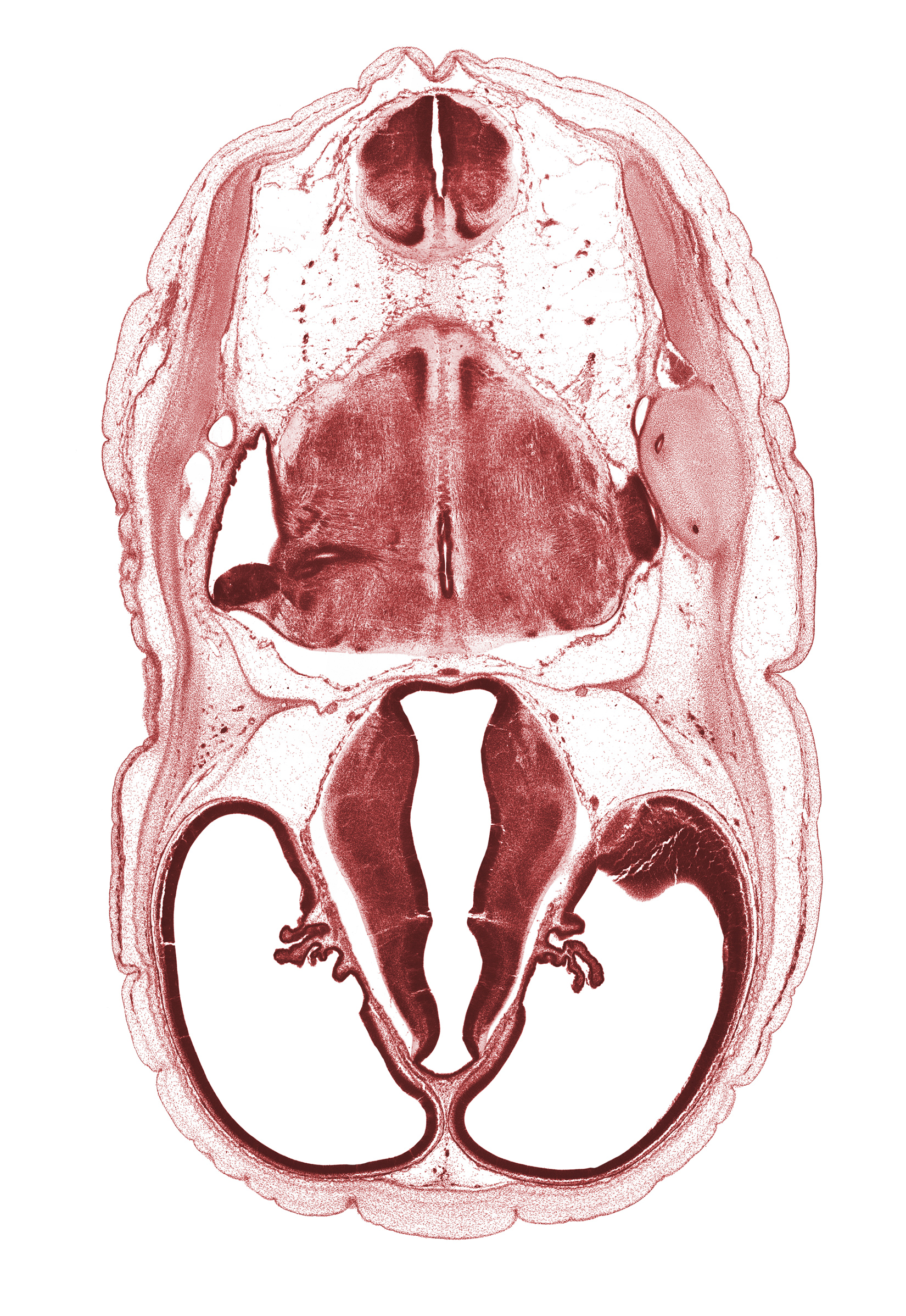 artifact space(s), basilar artery, choroid plexus, endolymphatic sac, exoccipital, hypothalamic sulcus, hypothalamus, lateral ventricular eminence (telencephalon), otic capsule cartilage, posterior communicating artery, posterior semicircular duct, region of cervical flexure, sigmoid sinus, subarachnoid space, sulcus medius, vascular plexus