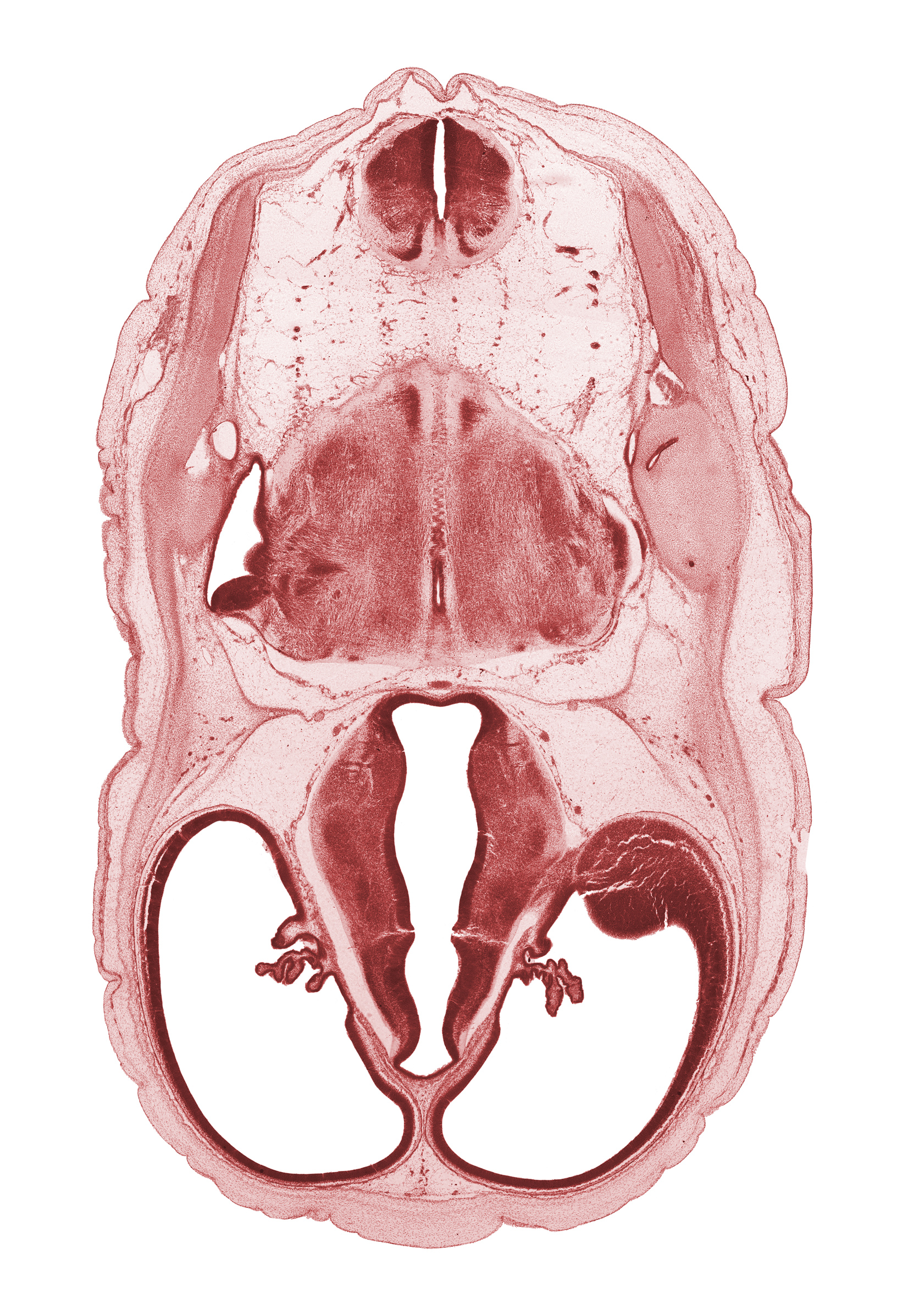 cerebral vesicle (hemisphere), decussation, dorsal thalamus, dural band for tentorium cerebelli, endolymphatic duct, glossopharyngeal nerve (CN IX), hypothalamus, lateral ventricle, lateral ventricular eminence (telencephalon), marginal ridge, median sulcus, myelencephalon, posterior semicircular duct, root of hypoglossal nerve (CN XII), subarachnoid space, ventral thalamus