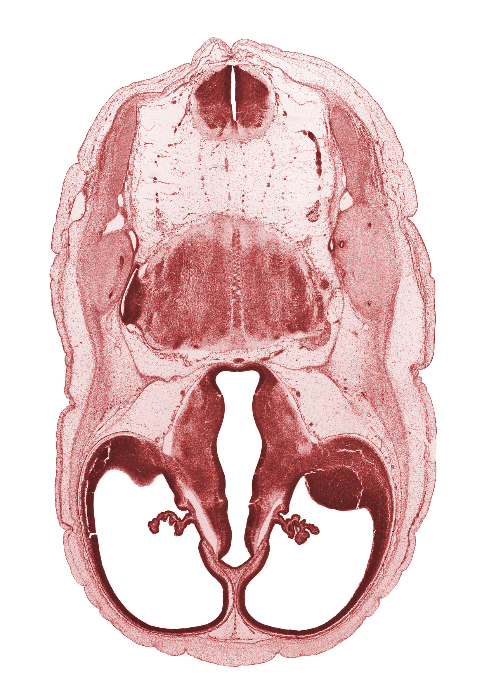 accessory nerve (CN XI), anterior semicircular duct, basilar artery, central canal of myelencephalon, common crus, dorsal thalamus, endolymphatic duct, exoccipital, fiber tract, glossopharyngeal nerve (CN IX), hypothalamus, lateral ventricle, lateral ventricular eminence (telencephalon), otic capsule cartilage, posterior communicating artery, stem of posterior dural venous plexus, vagus nerve (CN X), ventral thalamus