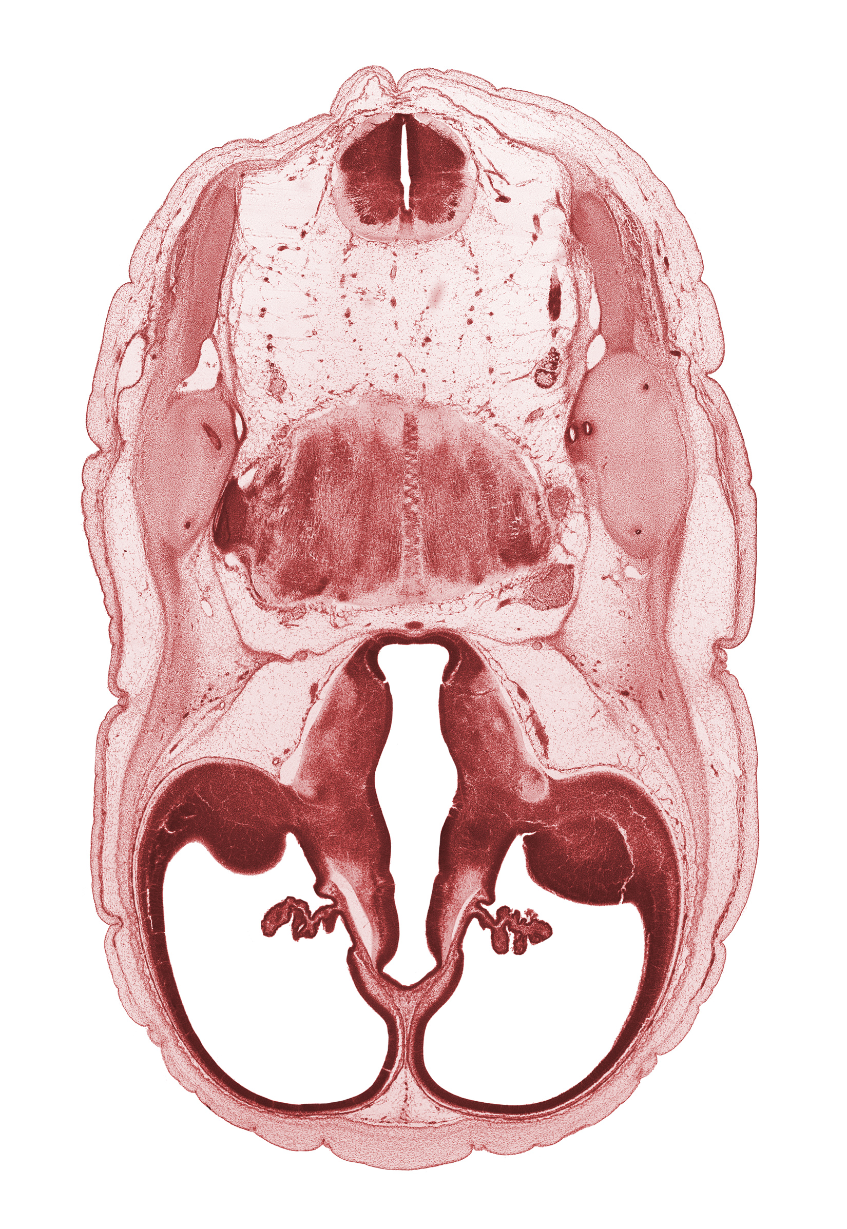 anterior semicircular duct, central canal, choroid plexus, common crus, decussation, diencephalon fiber tract, dorsal thalamus, endolymphatic duct, hypothalamic sulcus, hypothalamus, junction of brain and spinal cord, lateral ventricle, otic capsule cartilage, roof plate of diencephalon, root of hypoglossal nerve (CN XII), sigmoid sinus, subarachnoid space, sulcus dorsalis, third ventricle, ventral thalamus, zona limitans intrathalamica