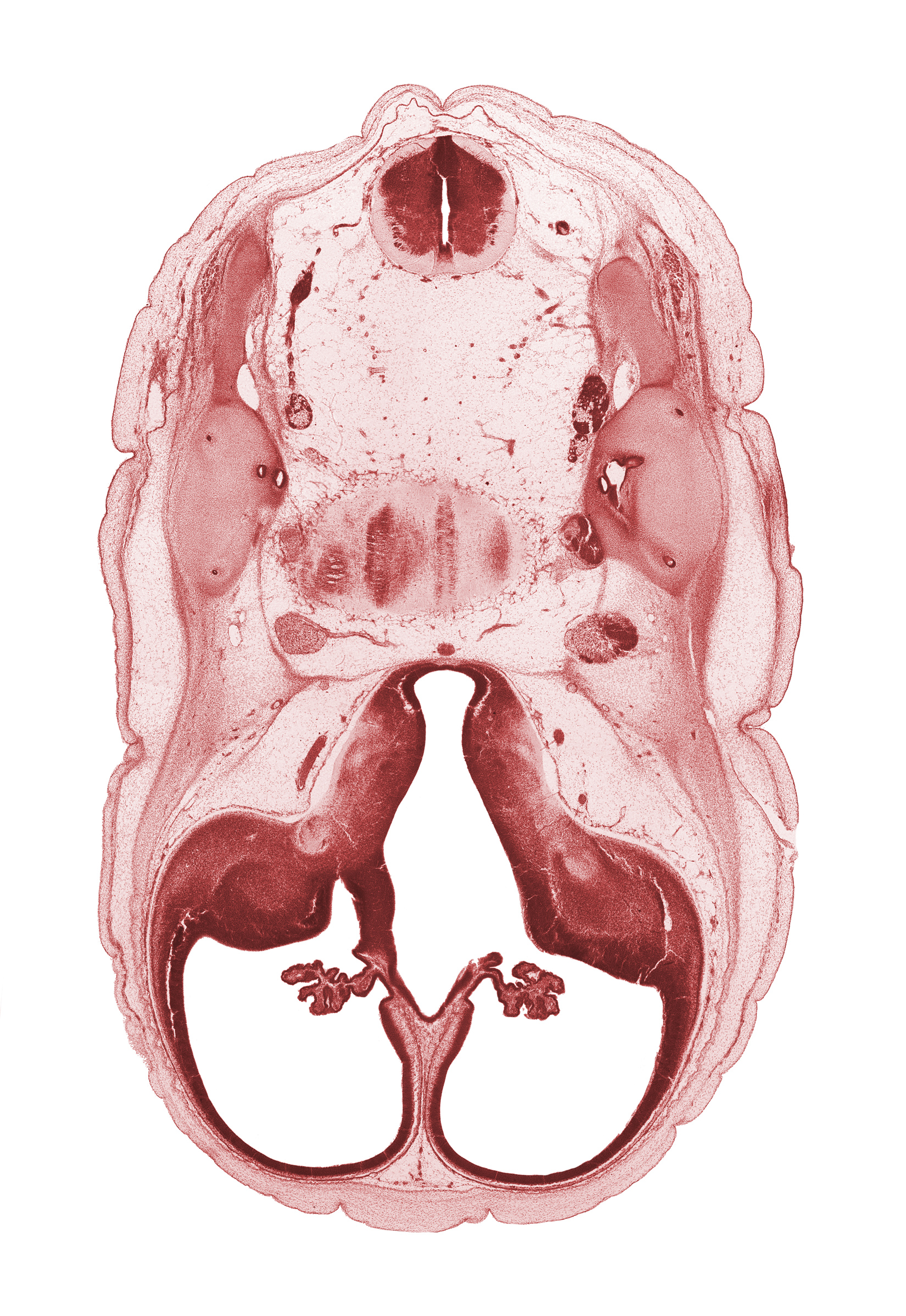 accessory nerve (CN XI), anterior semicircular duct, basilar artery, choroid plexus, decussation, endolymphatic duct, falx cerebri region, hypothalamus, interventricular foramen, lateral ventricle, posterior communicating artery, posterior semicircular duct, primordial cortical plate, sigmoid sinus, superior ganglion of vagus nerve (CN X), third ventricle, utricle, venous plexus(es)