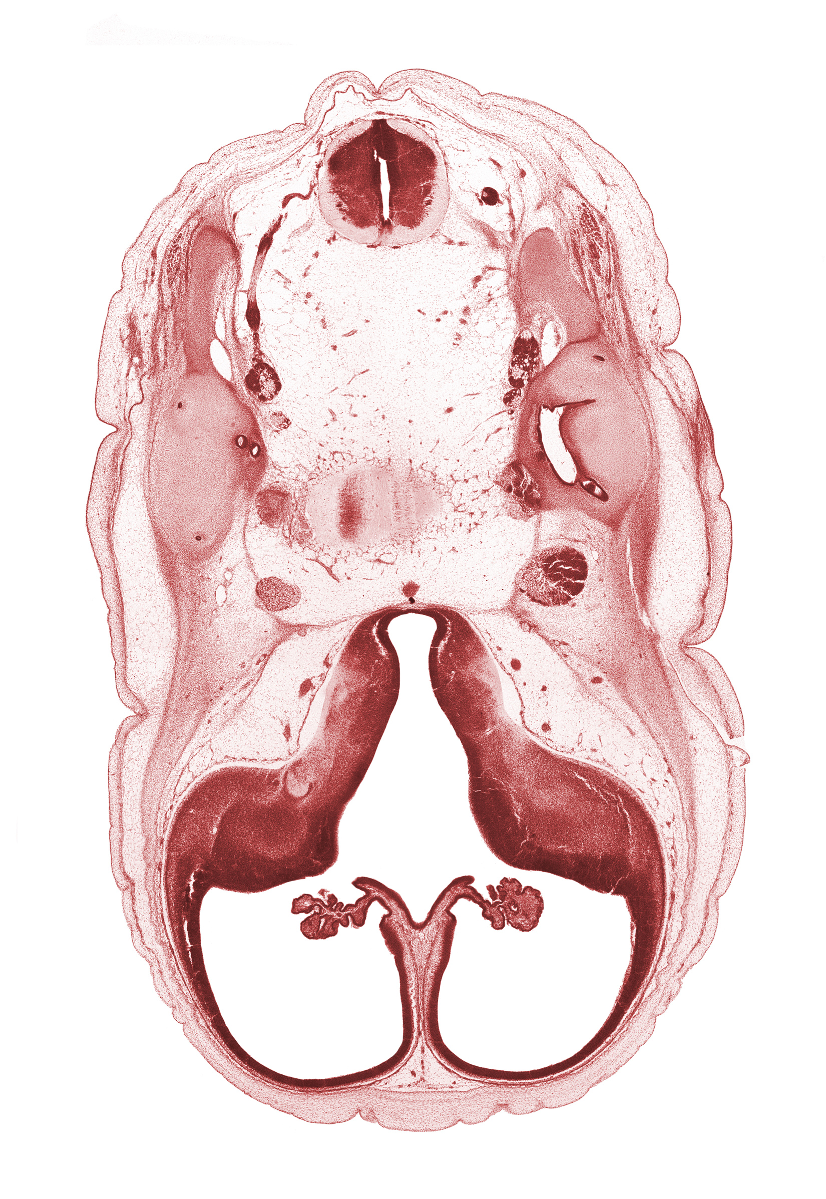 C-1 spinal ganglion, C-1 ventral root, accessory nerve (CN XI), basilar artery, central canal of spinal cord, cerebral vesicle (hemisphere), edge of pons region (metencephalon), facial nerve (CN VII), hypothalamus, lateral ventricle, otic capsule cartilage, posterior communicating artery, primordial cortical plate, roof plate of diencephalon, subarachnoid space, superior ganglion of glossopharyngeal nerve (CN IX), superior ganglion of vagus nerve (CN X), third ventricle, trigeminal ganglion (CN V), vestibulocochlear ganglion (CN VIII)