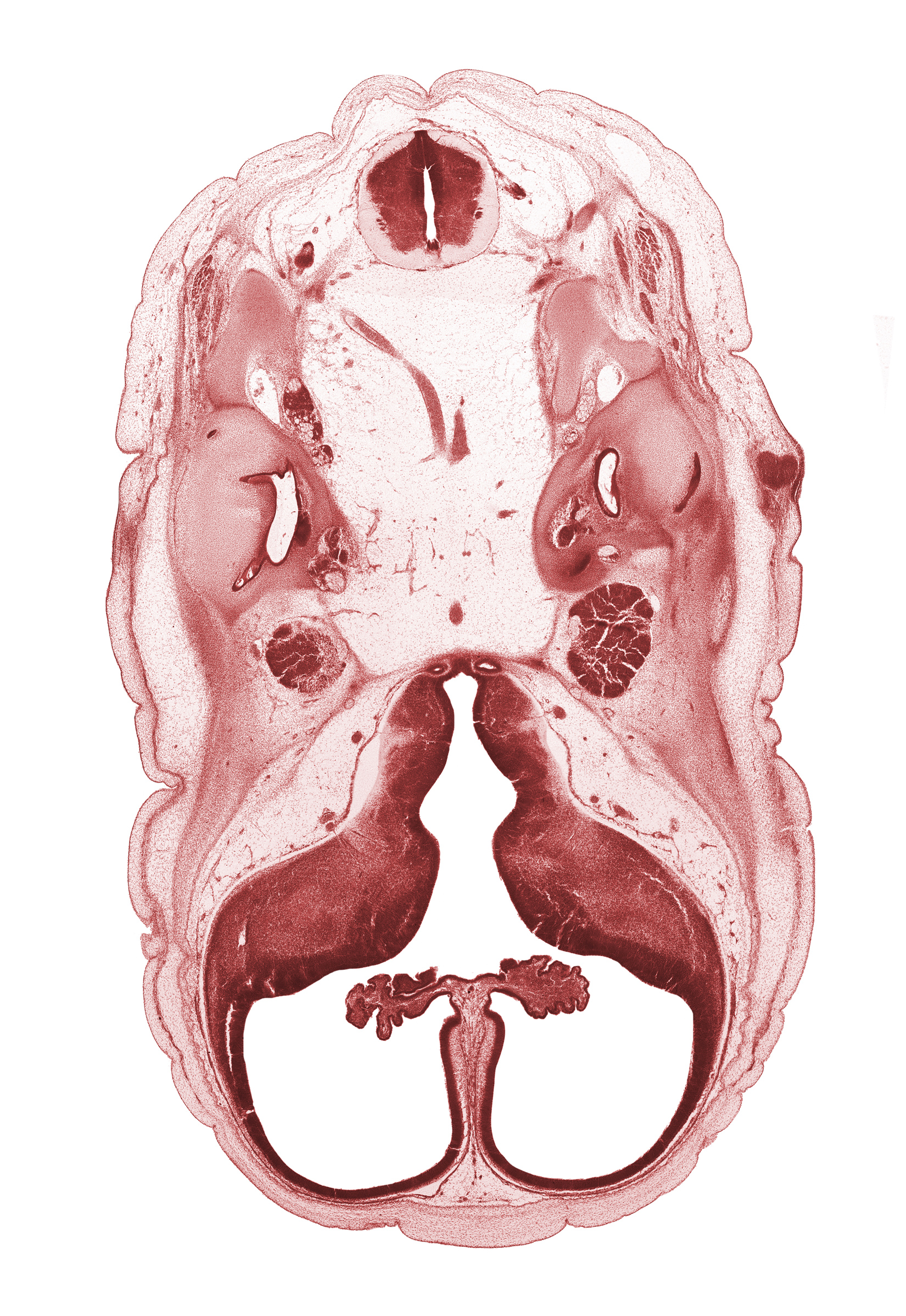 C-1 spinal nerve, anterior semicircular duct, artifact separation(s), basilar artery, choroid plexus, facial nerve (CN VII), hypothalamic sulcus, hypothalamus, interventricular foramen, junction of basilar artery and vertebral arteries, lateral semicircular duct, lateral ventricle, lateral ventricular eminence (telencephalon), medial ventricular eminence (diencephalon), motor root of trigeminal nerve (CN V), neurohypophysis, osteogenic layer, posterior semicircular duct, saccule(s), sigmoid sinus, spinal accessory nerve (CN XI), subarachnoid space, third ventricle, tuberal part of adenohypophysis, utricle, vertebral artery