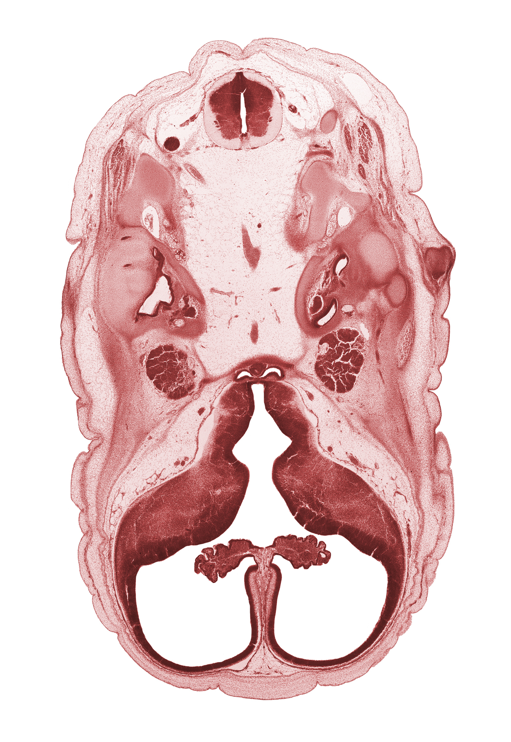 C-1 spinal nerve, abducens nerve (CN VI), basilar artery, central canal, cerebral vesicle (hemisphere), choroid plexus, cochlear duct, facial nerve (CN VII), falx cerebri region, head mesenchyme, hypoglossal nerve (CN XII), interventricular foramen, junction of basilar artery and vertebral arteries, lateral ventricle, lateral ventricular eminence (telencephalon), medial ventricular eminence (diencephalon), neurohypophysis, otic capsule cartilage, pharyngeal arch 1 cartilage (Meckel), posterior communicating artery, subarachnoid space, trigeminal ganglion (CN V), utricle, venous plexus(es), vertebral artery