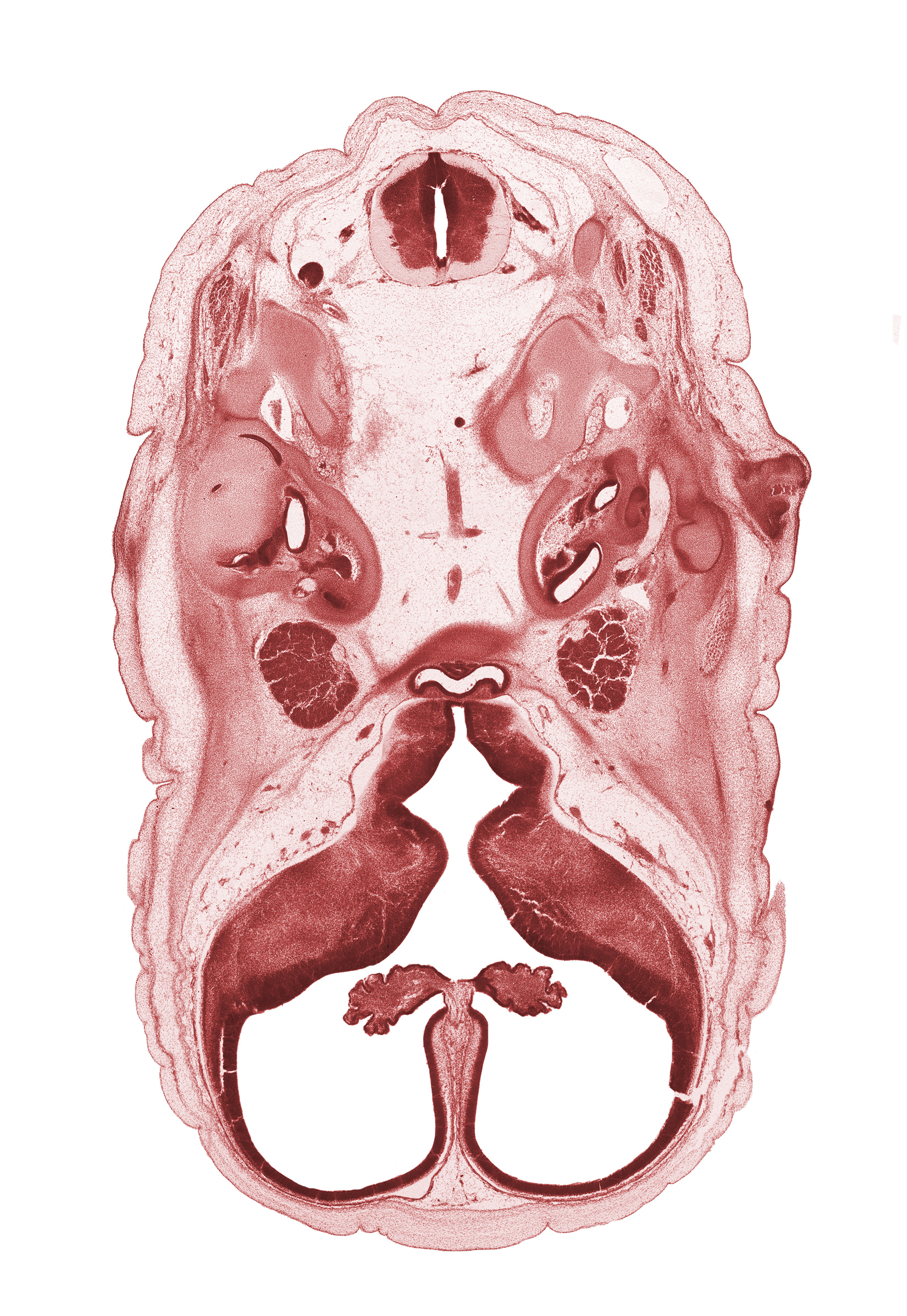 abducens nerve (CN VI), adenohypophysis, artifact separation(s), auricle, falx cerebri region, geniculate ganglion (CN VII), horizontal part of facial nerve (CN VII), hypothalamic sulcus, hypothalamus, intermediate zone, lateral ventricle, lateral ventricular eminence (telencephalon), marginal zone, medial ventricular eminence (diencephalon), motor root of trigeminal nerve (CN V), pharyngeal arch 1 cartilage (Meckel), posterior semicircular duct, roof plate of diencephalon, saccule(s), sella tursica region, spinal accessory nerve (CN XI), subarachnoid space, temporalis muscle, third ventricle, ventricular zone