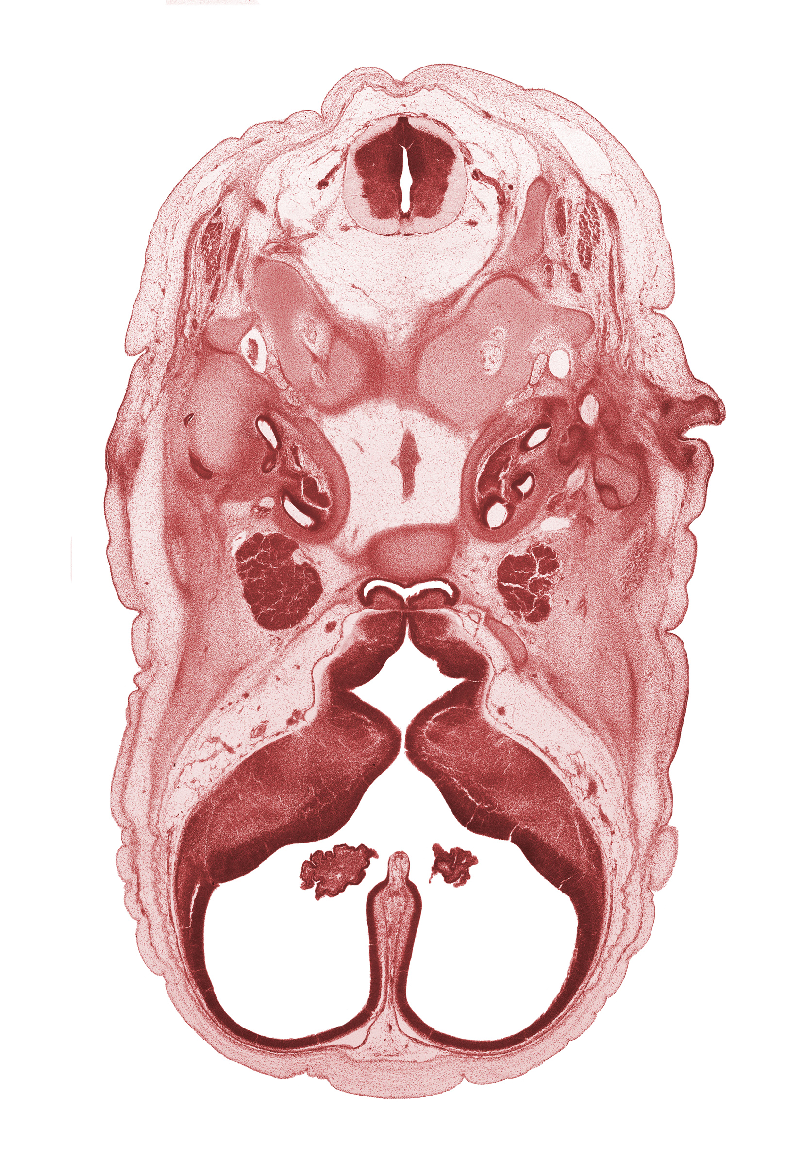 abducens nerve (CN VI), adenohypophysis, alar plate(s), basal plate, basi-occipital (basal plate), basilar artery, edge of choroid plexus, floor plate, hypoglossal nerve (CN XII), interventricular foramen, lateral semicircular duct, lateral ventricle, lateral ventricular eminence (telencephalon), medial ventricular eminence (diencephalon), neural arch of C-1 vertebra (atlas), occipital condyle, optic groove, orbitosphenoid, posterior communicating artery, roof plate, sulcus limitans, third ventricle, vagus nerve (CN X)