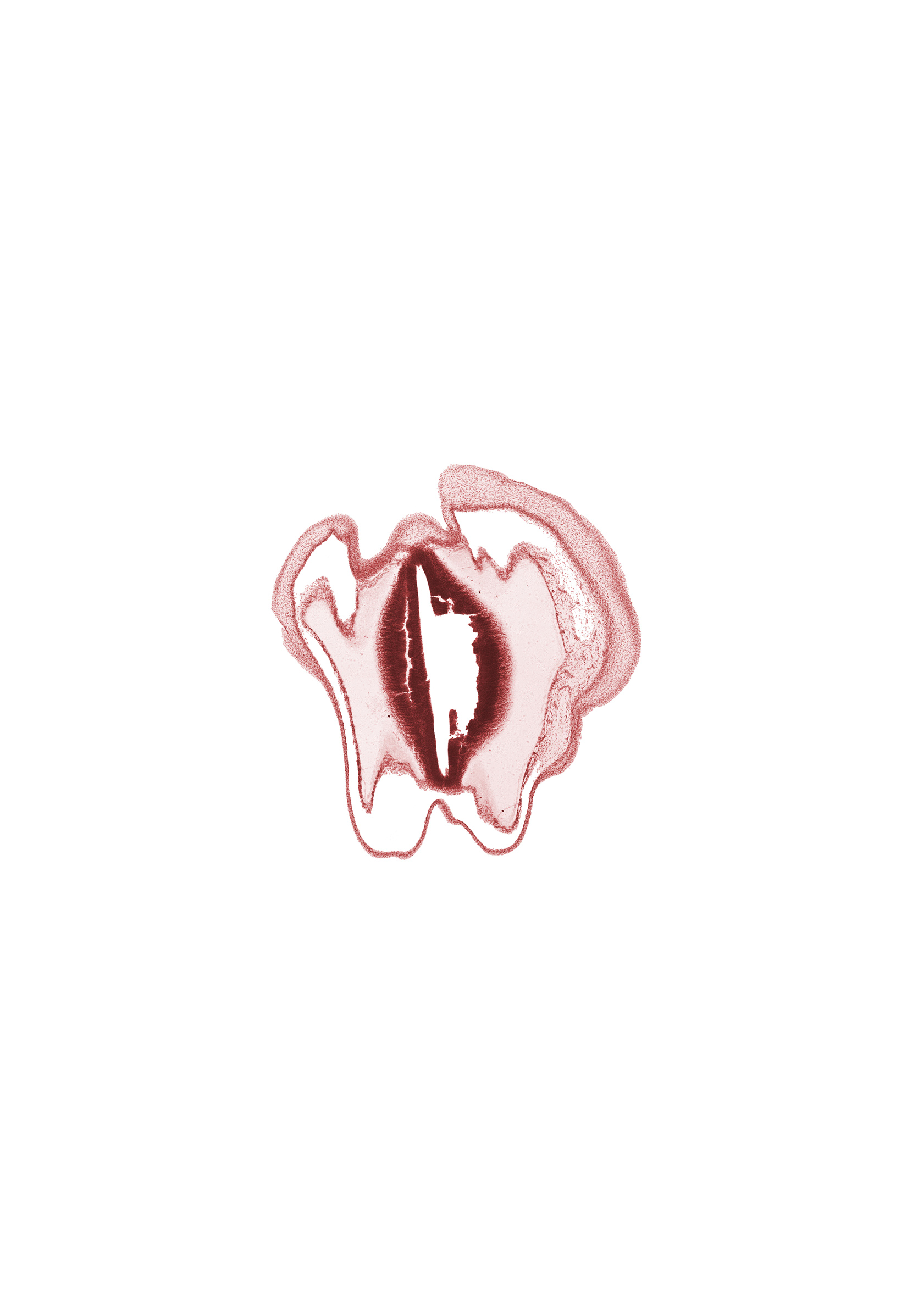 artifact fracture(s), artifact space(s), cerebral aqueduct (mesocoele), missing tissue, osteogenic layer, subarachnoid space, surface ectoderm, vascular plexus