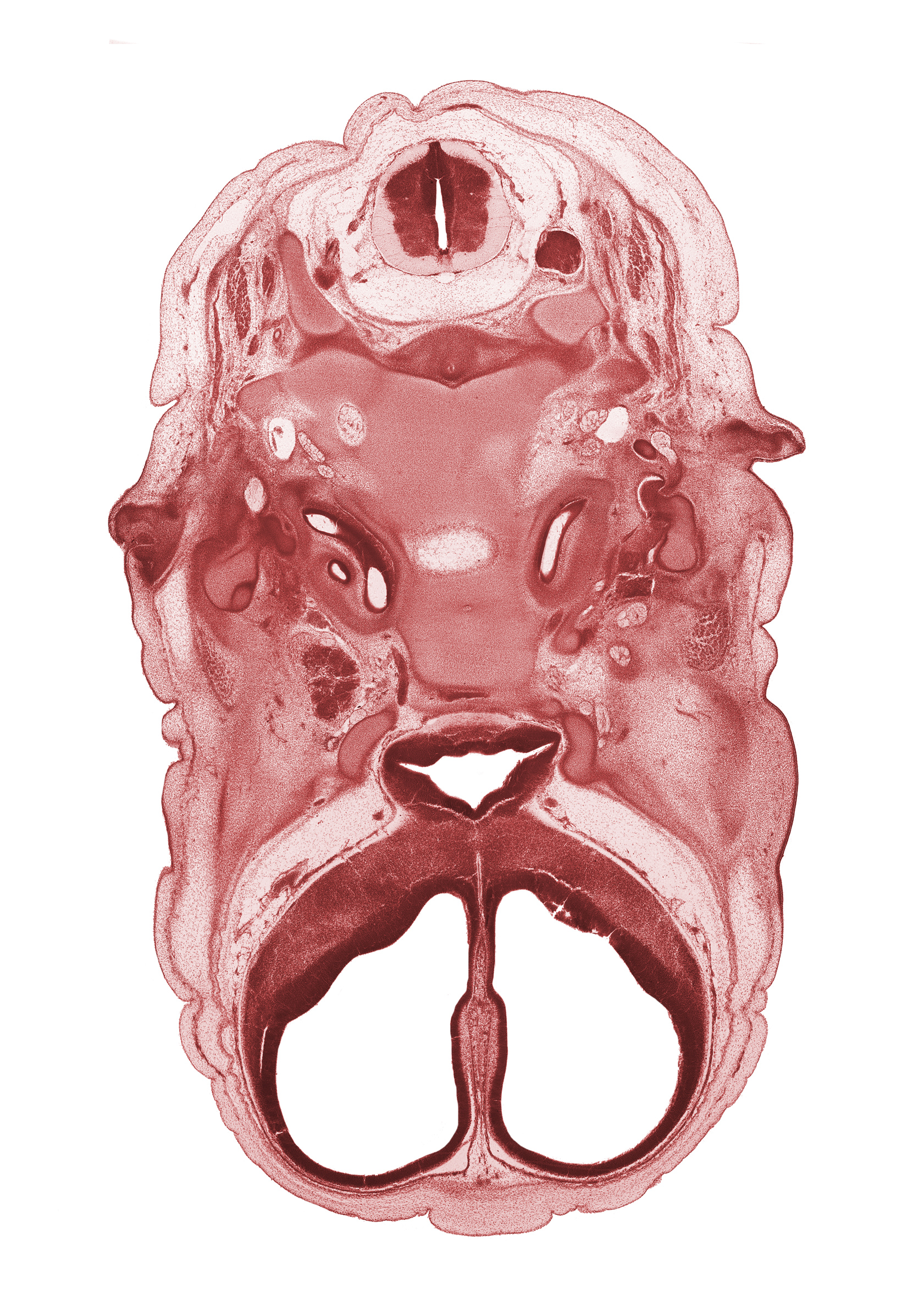 C-2 spinal ganglion, anterior cerebral artery, basi-occipital (basal plate), body of sphenoid, caudal edge of cranial cavity, central canal, cephalic edge of dens of C-2 vertebra (axis), cervical plexus, chorda tympani nerve, cochlear duct, falx cerebri region, hypoglossal canal, hypoglossal nerve (CN XII), internal carotid artery, lateral ventricle, mandibular nerve (CN V₃), maxillary nerve (CN V₂), ophthalmic nerve (CN V₁), optic chiasma (chiasmatic plate), orbitosphenoid, subarachnoid space, third ventricle