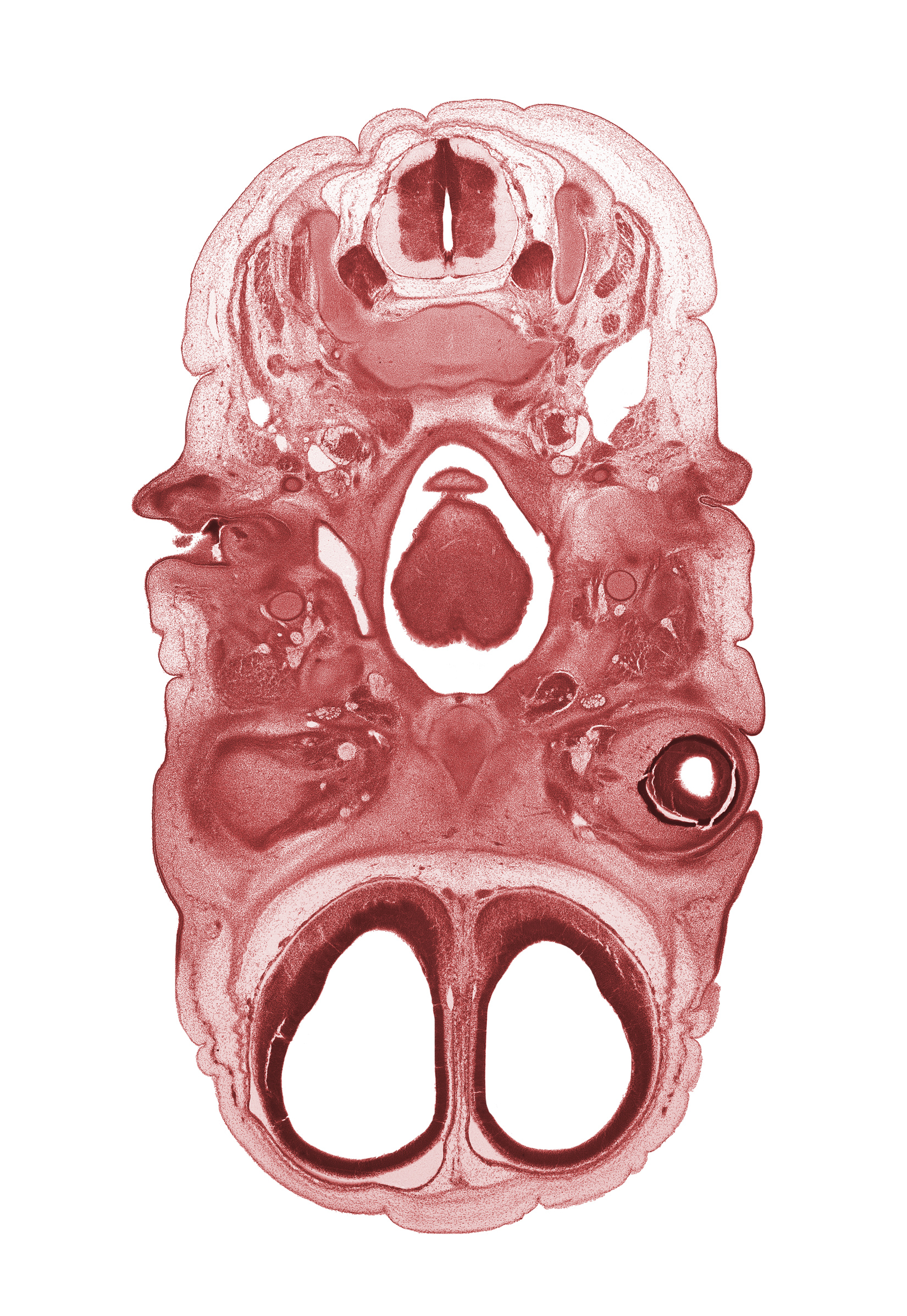 C-3 spinal ganglion, C-3 spinal nerve, cephalic edge of epiglottis, dura mater, edge of optic cup cavity, ethmoid, extrinsic ocular muscle(s), facial nerve (CN VII), glossopharyngeal nerve (CN IX), intraretinal space (optic vesicle cavity), laryngeal pharynx, optic nerve (CN II), oropharynx, osteogenic layer, pharyngeal arch 2 cartilage, pharyngeal hypophysis, spinal accessory nerve (CN XI), subarachnoid space, tongue, vascular plexus