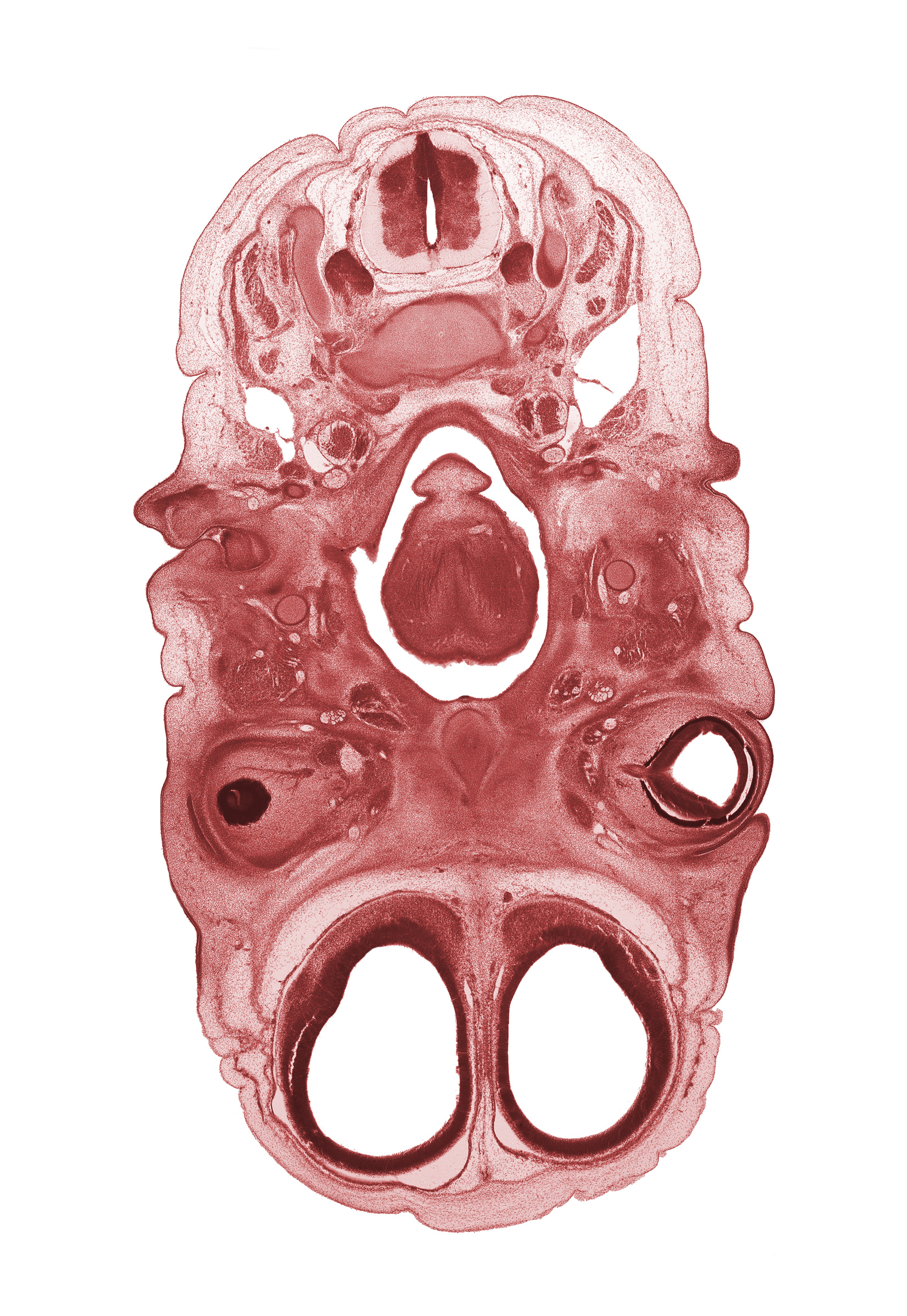 C-3 spinal ganglion, C-3 spinal nerve, anterior cerebral artery, artifact space(s), cornea, facial nerve (CN VII), glossopharyngeal nerve (CN IX), intraretinal space (optic vesicle cavity), optic cup cavity, optic nerve (CN II), pigmented layer of retina, retropharyngeal space, subarachnoid space, superior cervical sympathetic ganglion, vagus nerve (CN X)