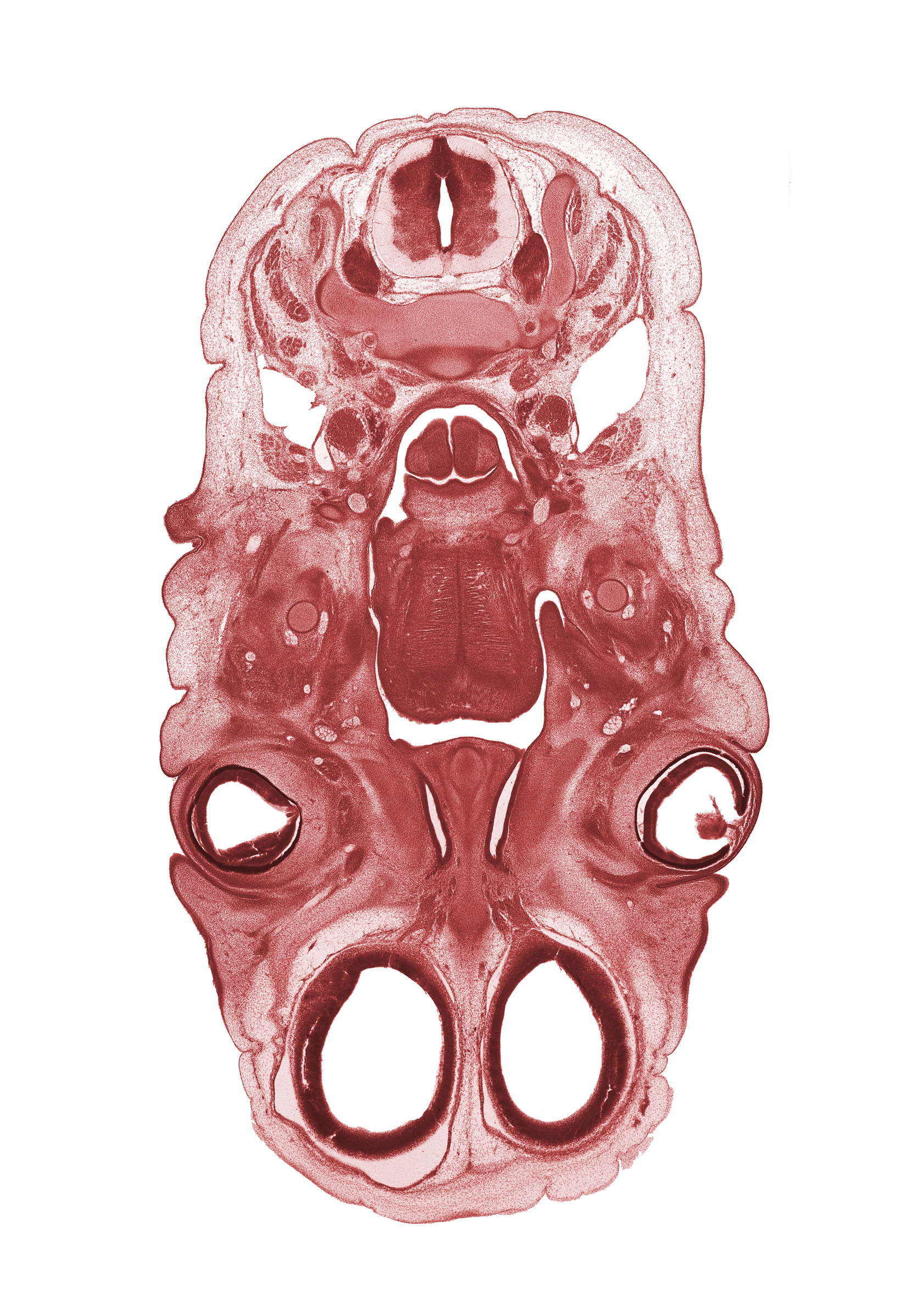 C-4 spinal ganglion, arytenoid swelling, epiglottis, falx cerebri region, glossopharyngeal nerve (CN IX), hypoglossal nerve (CN XII), intermediate zone, intraretinal space (optic vesicle cavity), jugular lymph sac, lens, levator palprebae superioris muscle, marginal zone, olfactory bulb, olfactory epithelium (placode), olfactory filia (CN I), optic cup cavity, osteogenic layer, pharyngeal arch 1 cartilage (Meckel), pterygoid muscle blastema, upper eyelid, ventricular zone
