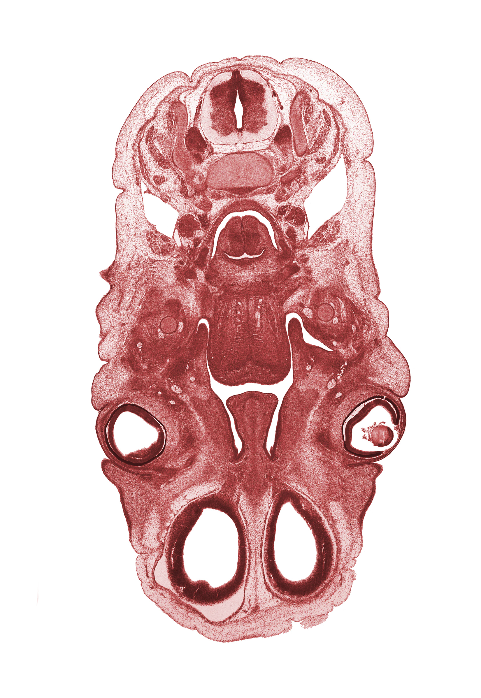 C-4 spinal ganglion, C-4 spinal nerve, artifact space(s), arytenoid swelling, caudal edge of auricle, cerebral vesicle (hemisphere), choana, cornea, glottis, horizontal layer of intrinsic muscles of tongue, intraretinal space (optic vesicle cavity), lens, lingual nerve, longitudinal intrinsic muscles of tongue, lower eyelid, nasal cavity (nasal sac), olfactory bulb, olfactory epithelium (placode), olfactory filia (CN I), optic cup cavity, palatine shelf, semispinalis capitis muscle, semispinalis cervicis muscle, spinal accessory nerve (CN XI), splenius muscle, sternocleidomastoid muscle, trapezius muscle, upper eyelid