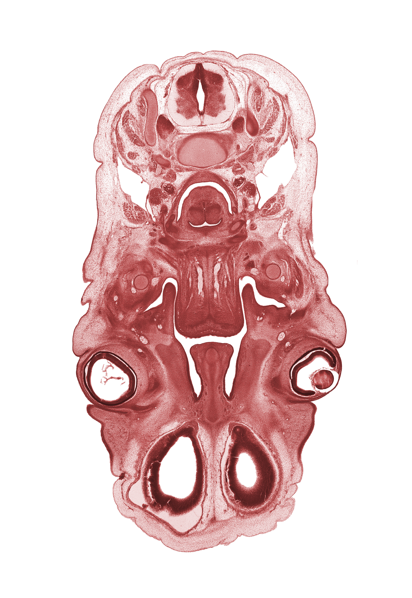 C-4 spinal ganglion, anterior scalene muscle, artifact fracture(s), cephalic edge of lateral ventricle, choana, cornea, head mesenchyme, hyaloid vessel(s), hypoglossal nerve (CN XII), intraretinal space (optic vesicle cavity), laryngeal pharynx, larynx, lens, masseter muscle, middle scalene muscle, nasal cavity (nasal sac), nasal septal cartilage, olfactory bulb, olfactory epithelium (placode), optic cup cavity, orbicularis oculi muscle, palatine shelf, platysma muscle, submandibular ganglion, surface ectoderm