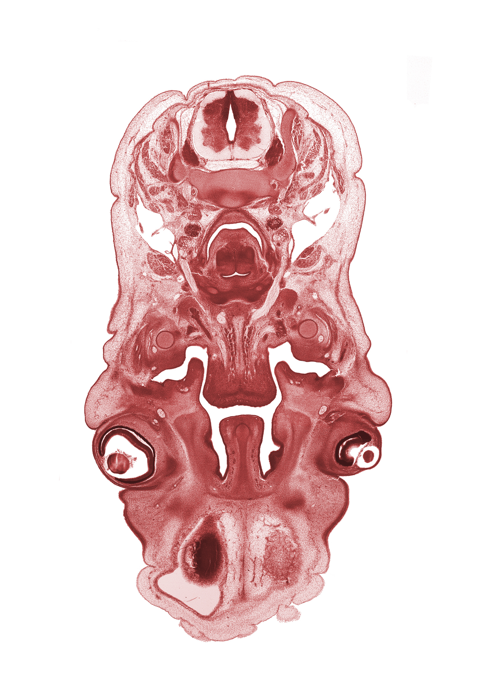 C-5 spinal ganglion, central canal, cerebral vesicle (hemisphere), cornea, edge of cerebral vesicle (hemisphere), glottis, hypoglossal nerve (CN XII), internal carotid artery, internal jugular vein, larynx, lens, lower eyelid, middle cervical sympathetic ganglion, nasal septal cartilage, neural arch, neural layer of retina, pigmented layer of retina, semispinalis capitis muscle, semispinalis cervicis muscle, splenius muscle, subarachnoid space, trapezius muscle, upper eyelid, vagus nerve (CN X), vertebral artery
