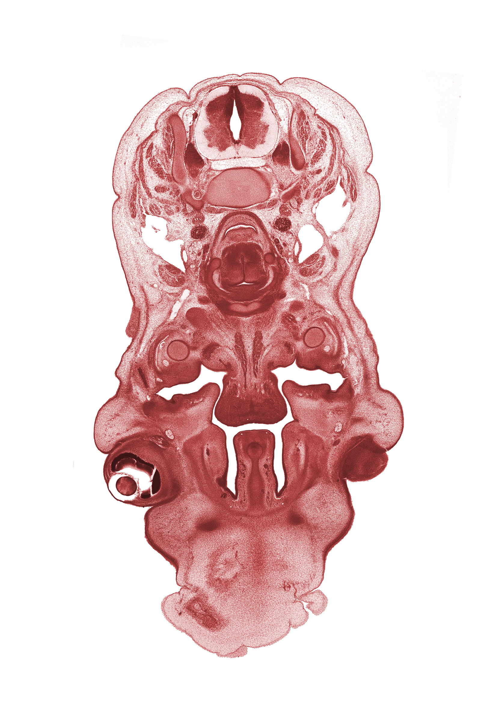 C-5 spinal ganglion, C-5 spinal nerve, artifact fracture(s), body of hyoid (pharyngeal arch 3 cartilage), choana, edge of eyeball, geniohyoid muscle, head mesenchyme, inferior alveolar nerve, inferior ganglion of vagus nerve (CN X), infra-orbital nerve, internal carotid artery, internal jugular vein, laryngeal pharynx, mandible, middle pharyngeal constrictor muscle, nasal cavity (nasal sac), osteogenic layer, palatine shelf, platysma muscle, sternocleidomastoid muscle, vertebral artery