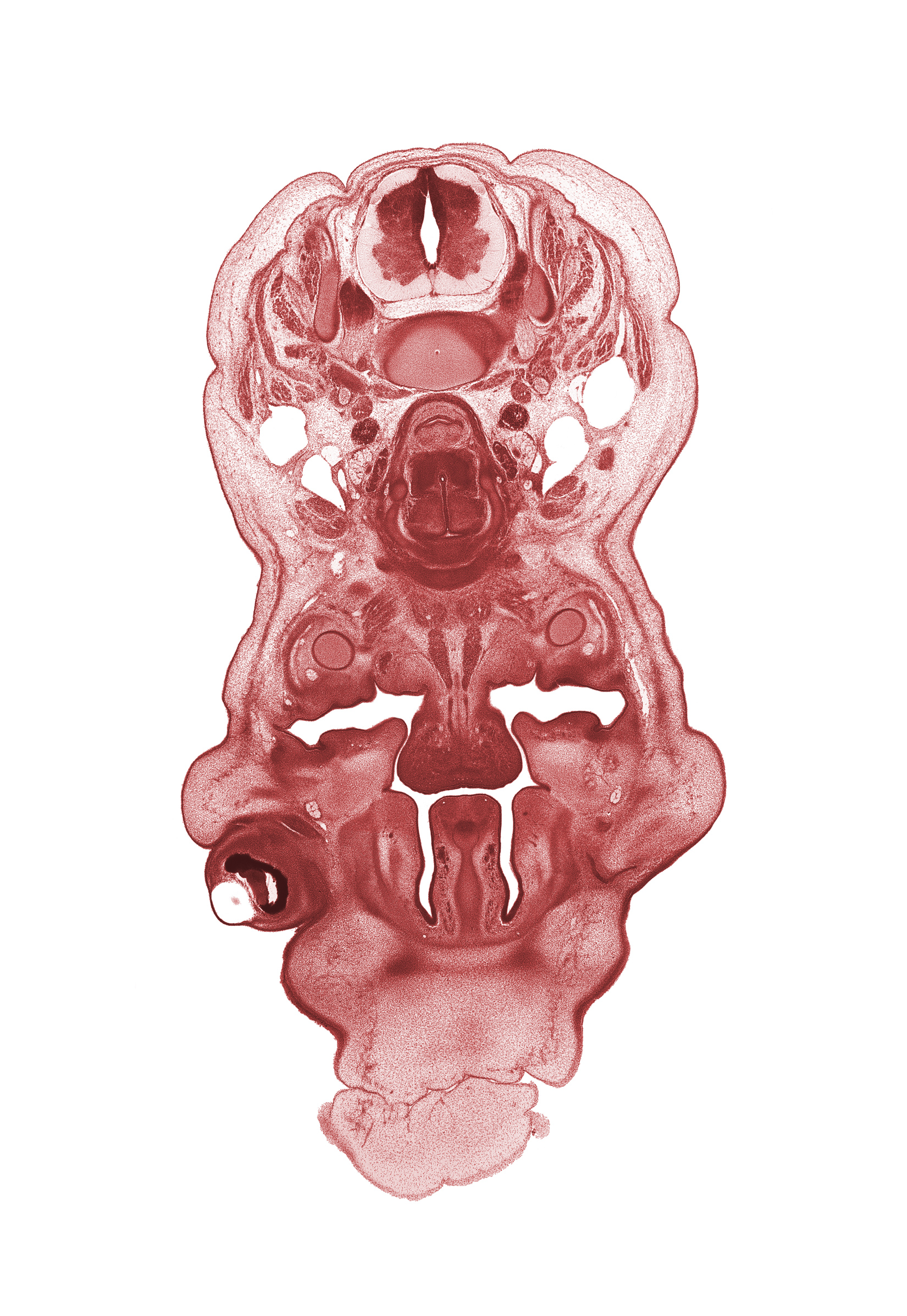 C-5 spinal nerve, anterior spinal vessels, head mesenchyme, inferior meatus, inferior nasal concha, internal jugular vein, interorbital ligament, jugular lymph sac, mandible, nasal cavity (nasal sac), oral cavity, palatine shelf, pharyngeal endoderm, platysma muscle, spinal accessory nerve (CN XI), sternocleidomastoid muscle, subarachnoid space, trapezius muscle
