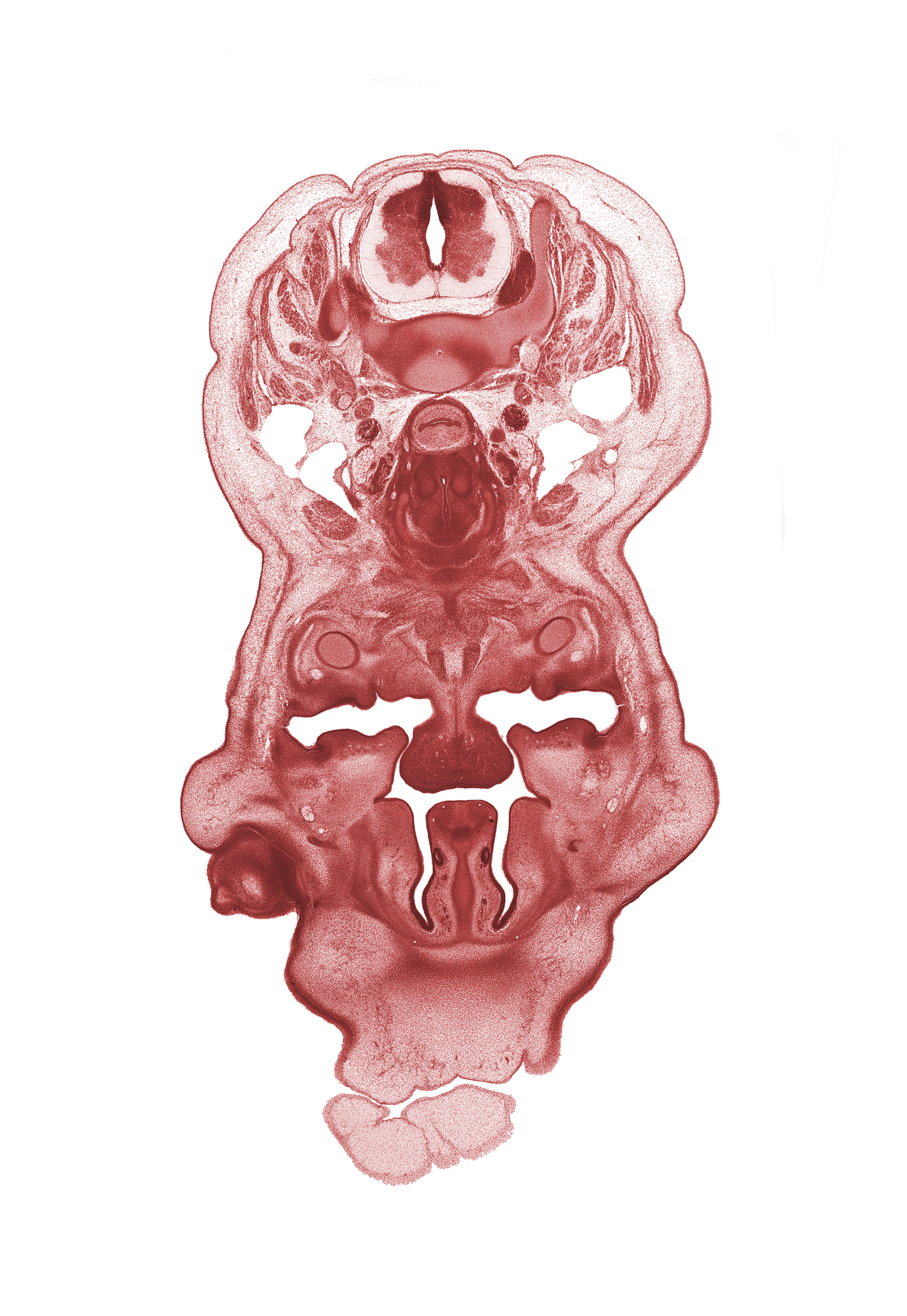 C-6 spinal ganglion, body of tongue, choana, edge of eyeball, edge of frontal prominence, esophagus endoderm, external jugular vein, head mesenchyme, infra-orbital nerve, internal jugular vein, interorbital ligament, jugular lymph sac, mandible, nasal capsule cartilage condensation, notochord, palatine shelf, pharyngeal arch 1 cartilage (Meckel), subarachnoid space, vomeronasal organ