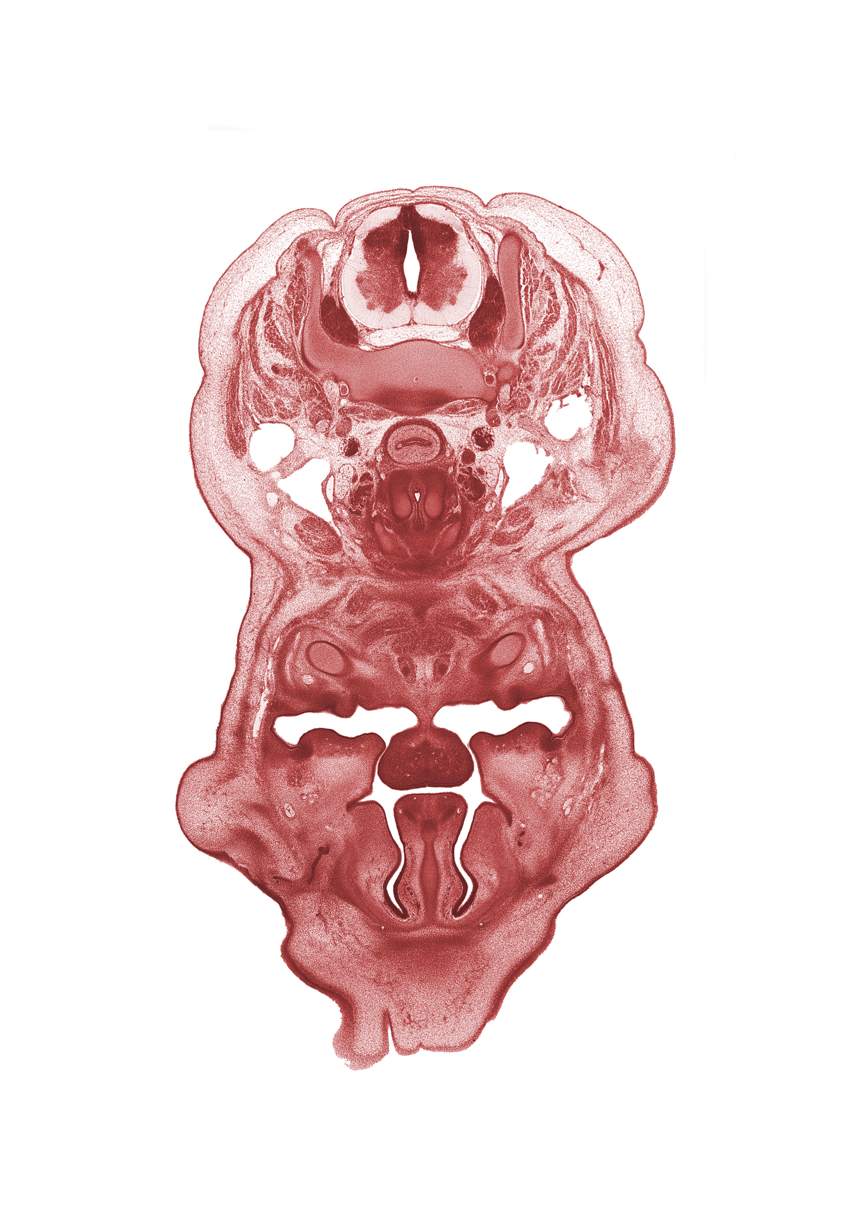 C-6 spinal ganglion, choana, frenulum of tongue, genioglossus muscle, geniohyoid muscle, inferior meatus, inferior nasal concha, internal jugular vein, interorbital ligament, jugular lymph sac, longus cervicis muscle, nasolacrimal duct, neural arch, oral cavity, palatine shelf, pharyngeal arch 1 cartilage (Meckel), platysma muscle, sternocleidomastoid muscle, thyroid cartilage, trapezius muscle