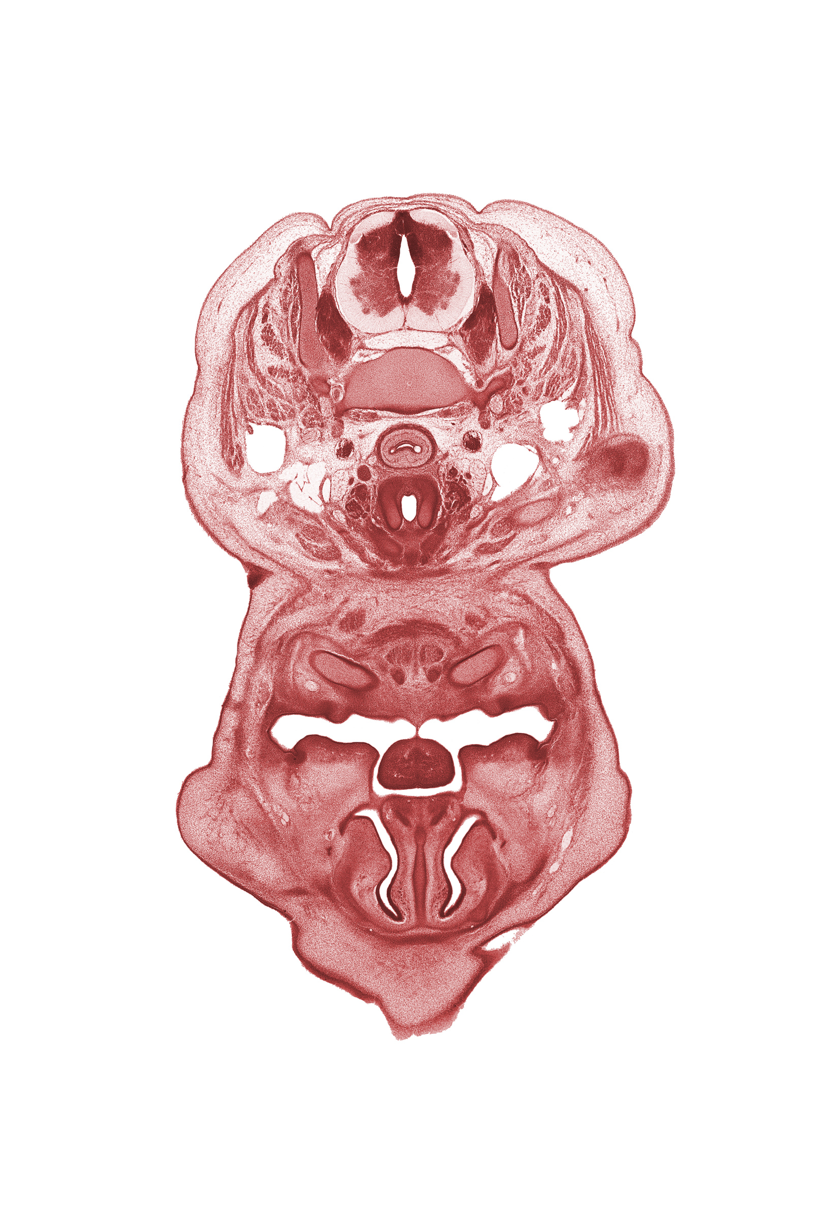 C-6 spinal ganglion, anterior belly of digastric muscle, central canal, cricoid cartilage, dorsal fasciculus, dorsum of tongue, esophagus endoderm, frenulum of tongue, inferior meatus, inferior nasal concha, internal carotid artery, internal jugular vein, jugular lymph sac, middle cervical sympathetic ganglion, mylohyoid muscle, nasal capsule cartilage condensation, nasal septal cartilage, nasolacrimal duct, neural arch, oral cavity, pharyngeal arch 1 cartilage (Meckel), superior parathyroid gland, thyroid gland, trapezius muscle