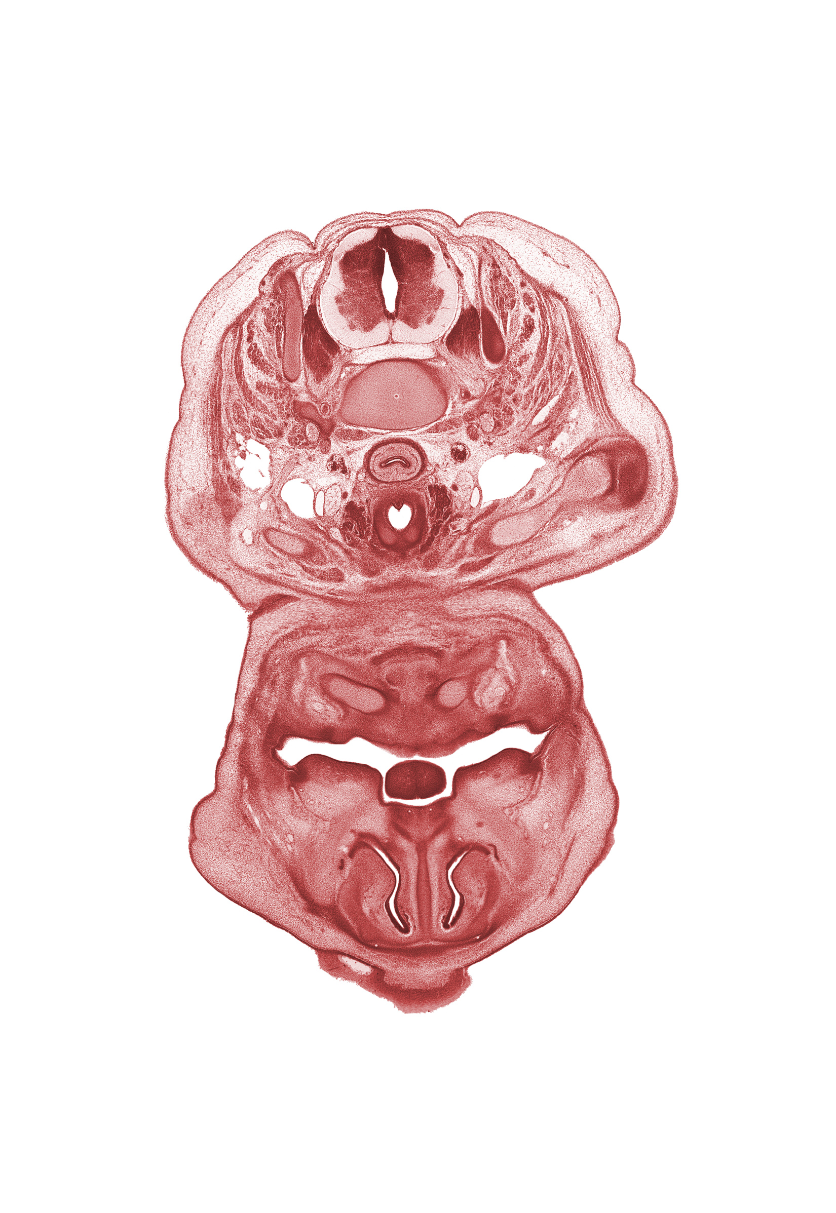 C-6 spinal ganglion, C-6 spinal nerve, anal pit, buccal region, clavicle, common carotid artery, external jugular vein, inferior alveolar nerve, infra-orbital lamina (facial muscle blastemata), internal jugular vein, middle cervical sympathetic ganglion, nasal capsule cartilage condensation, nasal cavity (nasal sac), nasal septal cartilage, pharyngeal arch 1 cartilage (Meckel), primary palate, semispinalis capitis muscle, semispinalis cervicis muscle, splenius muscle, subarachnoid space, thyroid gland, tongue, trapezius muscle