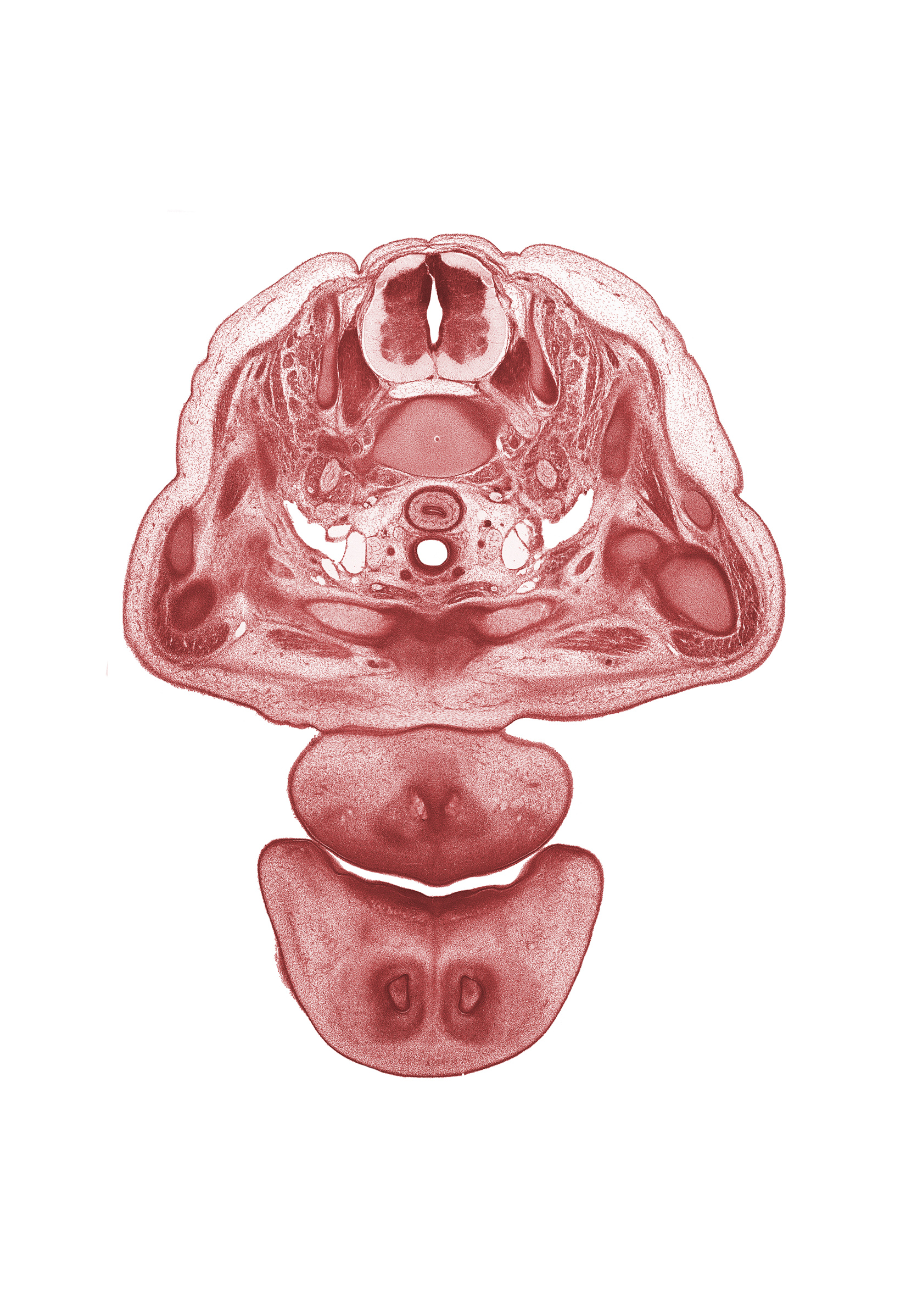 C-7 spinal ganglion, C-7 spinal nerve, anterior scalene muscle, central canal, dorsal horn of grey matter, epithelial plug in naris, esophagus muscularis, jugular lymph sac, longus cervicis muscle, primary palate, sympathetic trunk, tracheal lumen, upper trunk of brachial plexus (C-5, C-6), vagus nerve (CN X), ventral edge of pharyngeal arch 1 cartilage (Meckel), ventral horn of grey matter, white matter