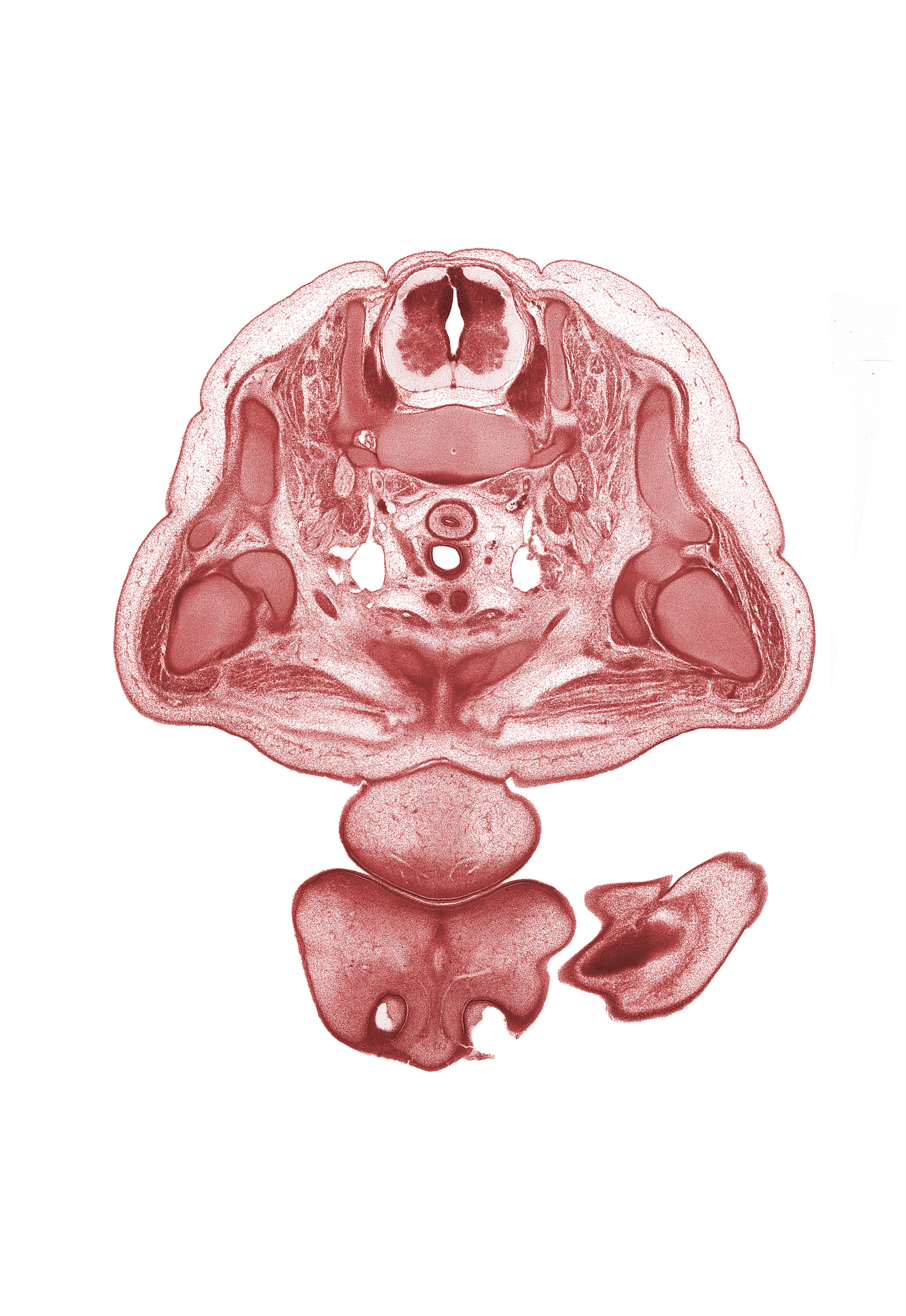 C-8 spinal ganglion, C-8 spinal nerve, anterior spinal artery, chin, deltoid muscle, esophagus endoderm, head of humerus, left brachiocephalic vein, metacarpal 2, middle trunk of brachial plexus (C-7), naris, neural arch, nose, oral fissure, pectoralis major muscle, right brachiocephalic vein, scapula, thymus gland, trapezius muscle, upper lip