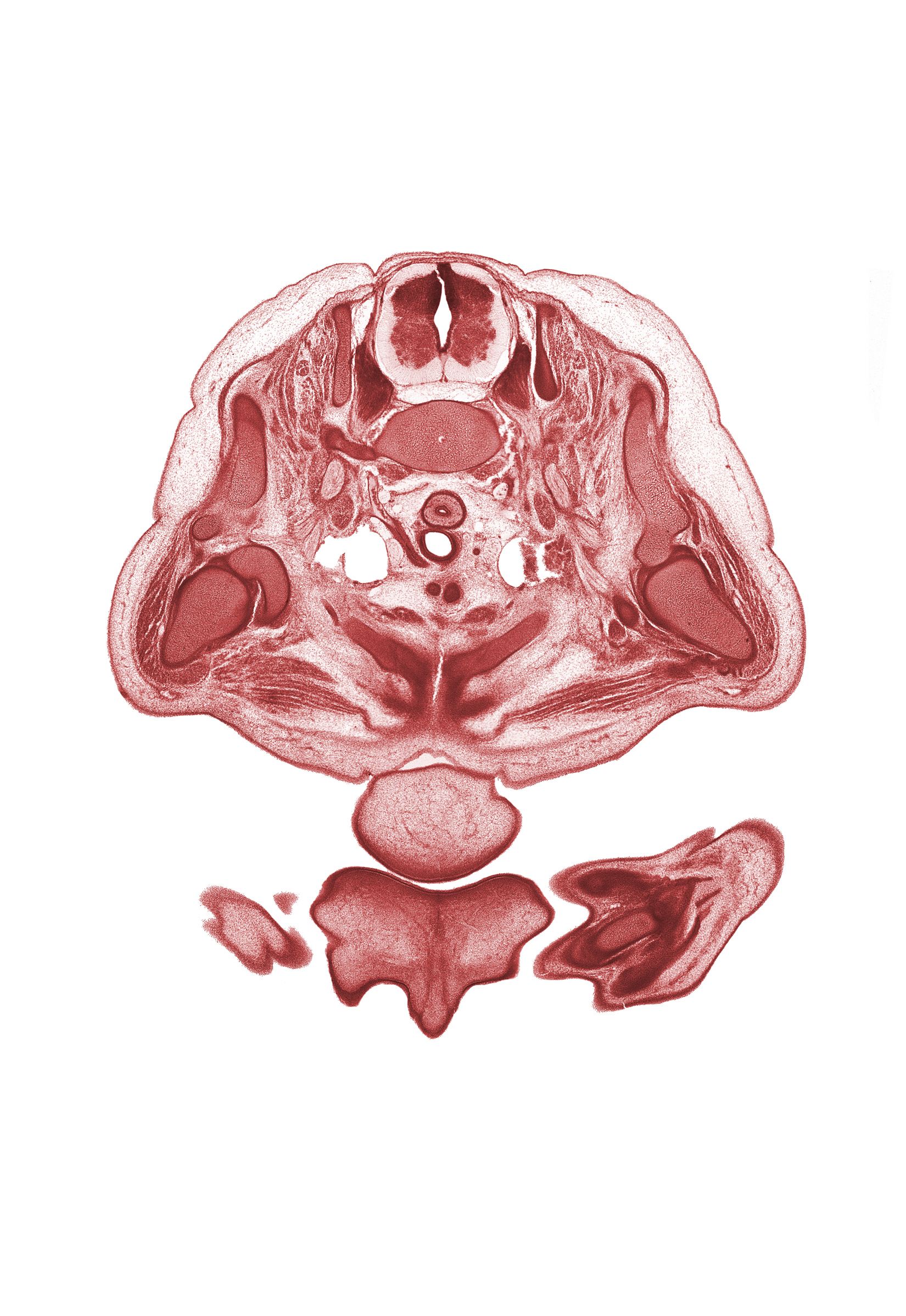 C-8 spinal ganglion, C-8 spinal nerve, central canal, centrum of C-7 vertebra, chin, columnella, common carotid artery, coracoid process of scapula, glenohumeral joint, humerus, metacarpal 1, naris, neural arch, notochord, primary palate, retro-esophageal space, rib 1, scapula, thymus gland, tracheal lumen