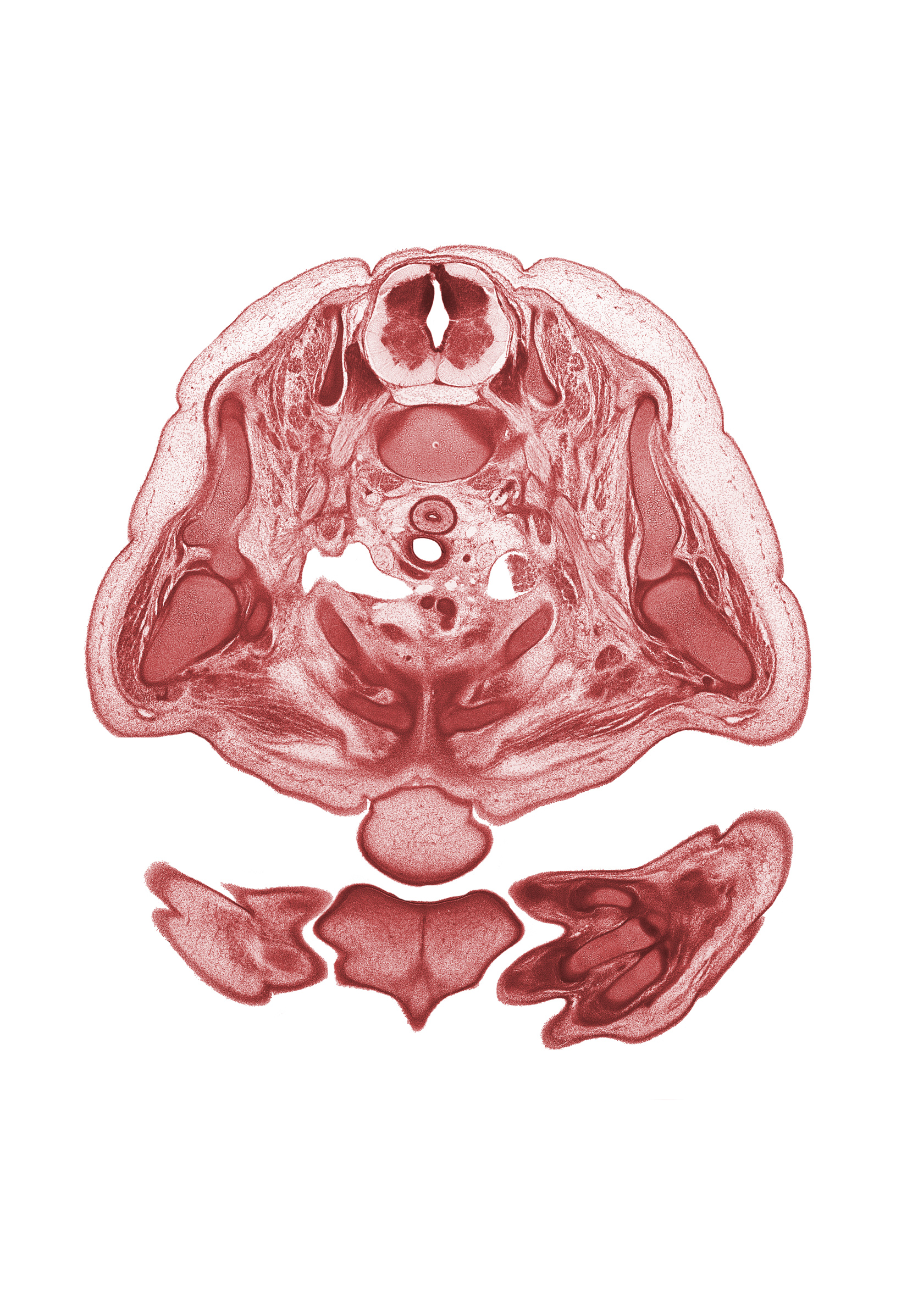 C-8 spinal ganglion, C-8 spinal nerve, chin, deltoid muscle, dorsal primary ramus, glenohumeral joint, head of humerus, hemisternum, left brachiocephalic vein, metacarpal 2, nose, scapula, spine of scapula, sympathetic trunk, trapezius muscle