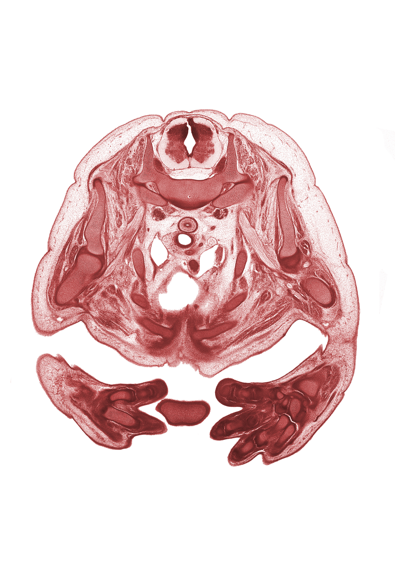 T-2 / T-3 interganglion region, ascending aorta, auricle of left atrium, auricle of right atrium, central canal, heart prominence, interventricular sulcus, left hand, left vagus nerve (CN X), left ventricle, neural arch, rib 3, rib 4, rib 5, rib 6, rib 7, right pulmonary artery, right vagus nerve (CN X), sulcus limitans, trabecular part of right ventricle, tracheal bifurcation, ulna, upper lobe of left lung